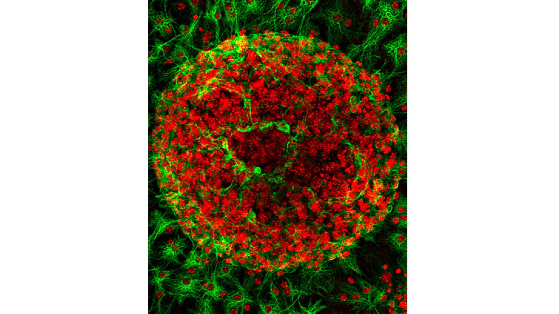 A mouse astrocyte.