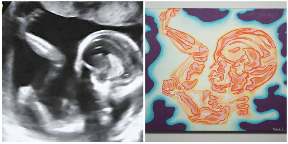 Inner Child Sonogram Painting