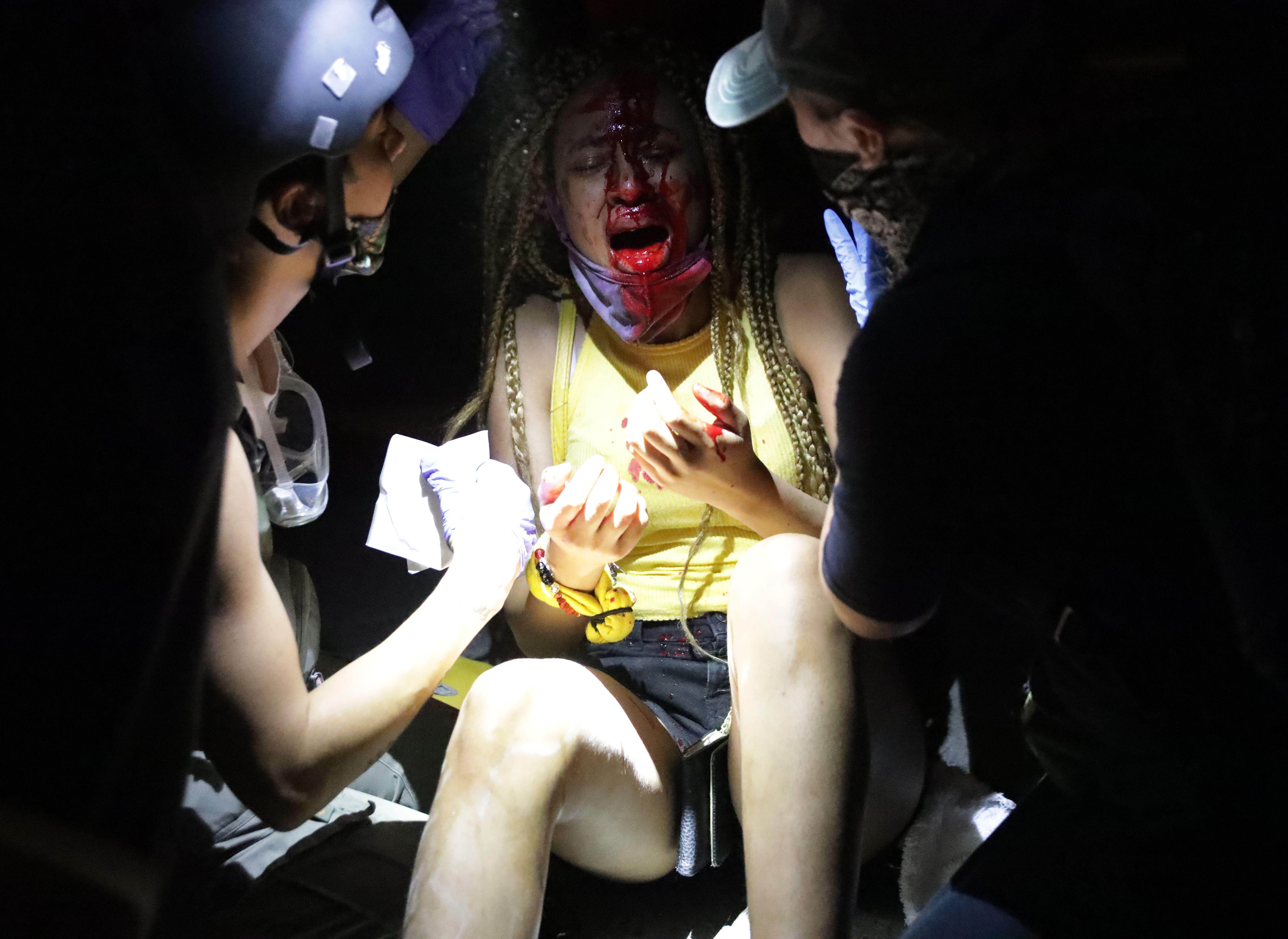 An injured women is tended to near the White House