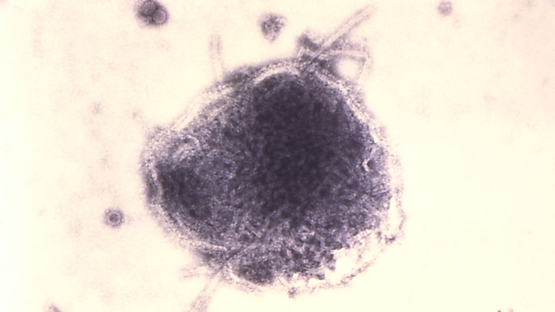 A colorized transmission electron micrograph showing measles virus and SV40 particles. Photo: Erskine Palmer/CDC/Smith Collection/Gado/Getty Images