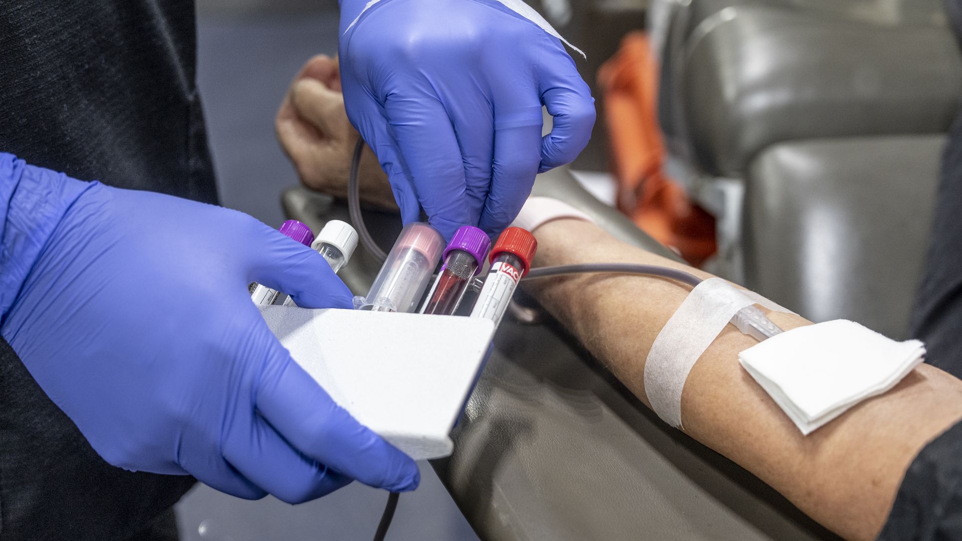A nurse filling test tubes with blood in Fullerton, California, in January 2022.