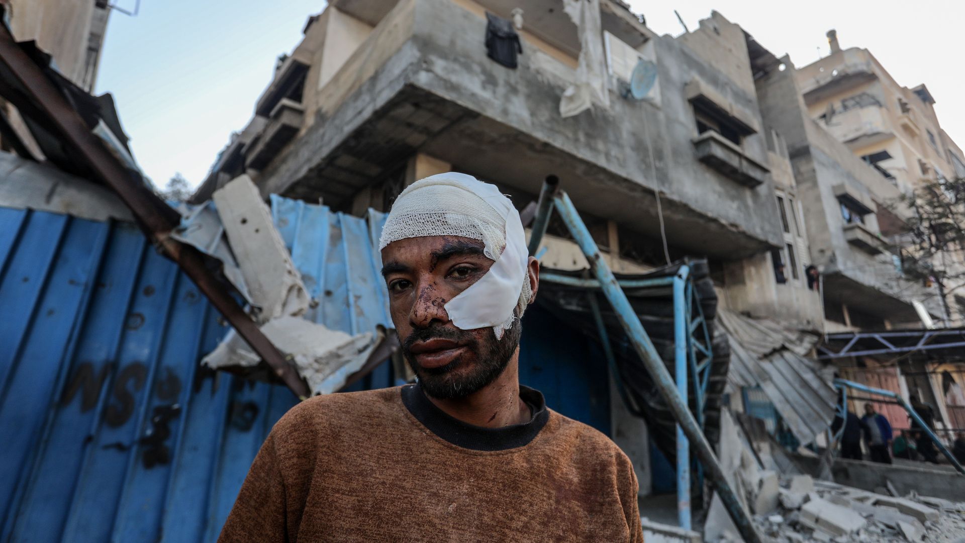  An injured Palestinian man as Palestinians inspect buildings destroyed or badly damaged due to Israeli attacks on Rafah City in the south of Gaz