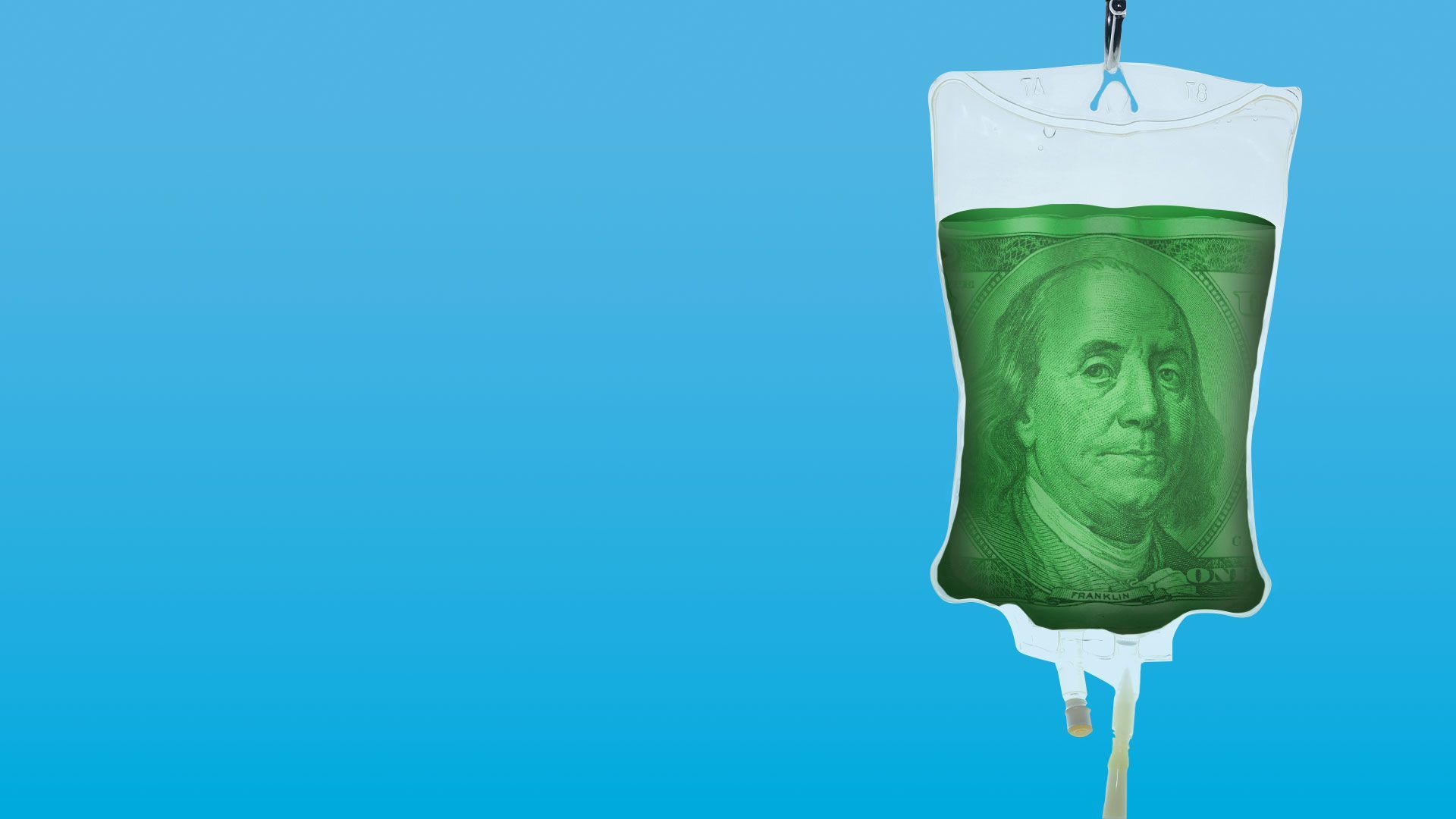 Illustration of a saline bag solution with money as the liquid in the bag.