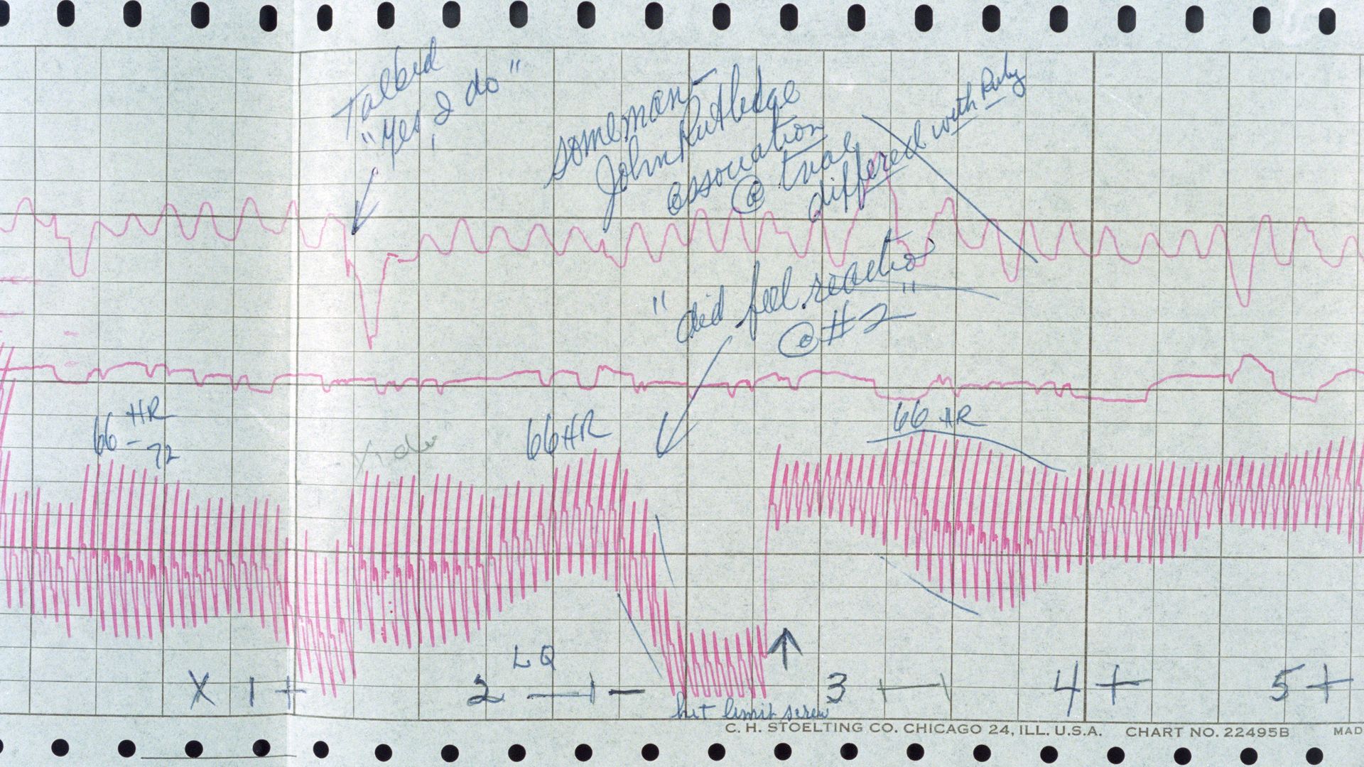 Image of an annotated polygraph