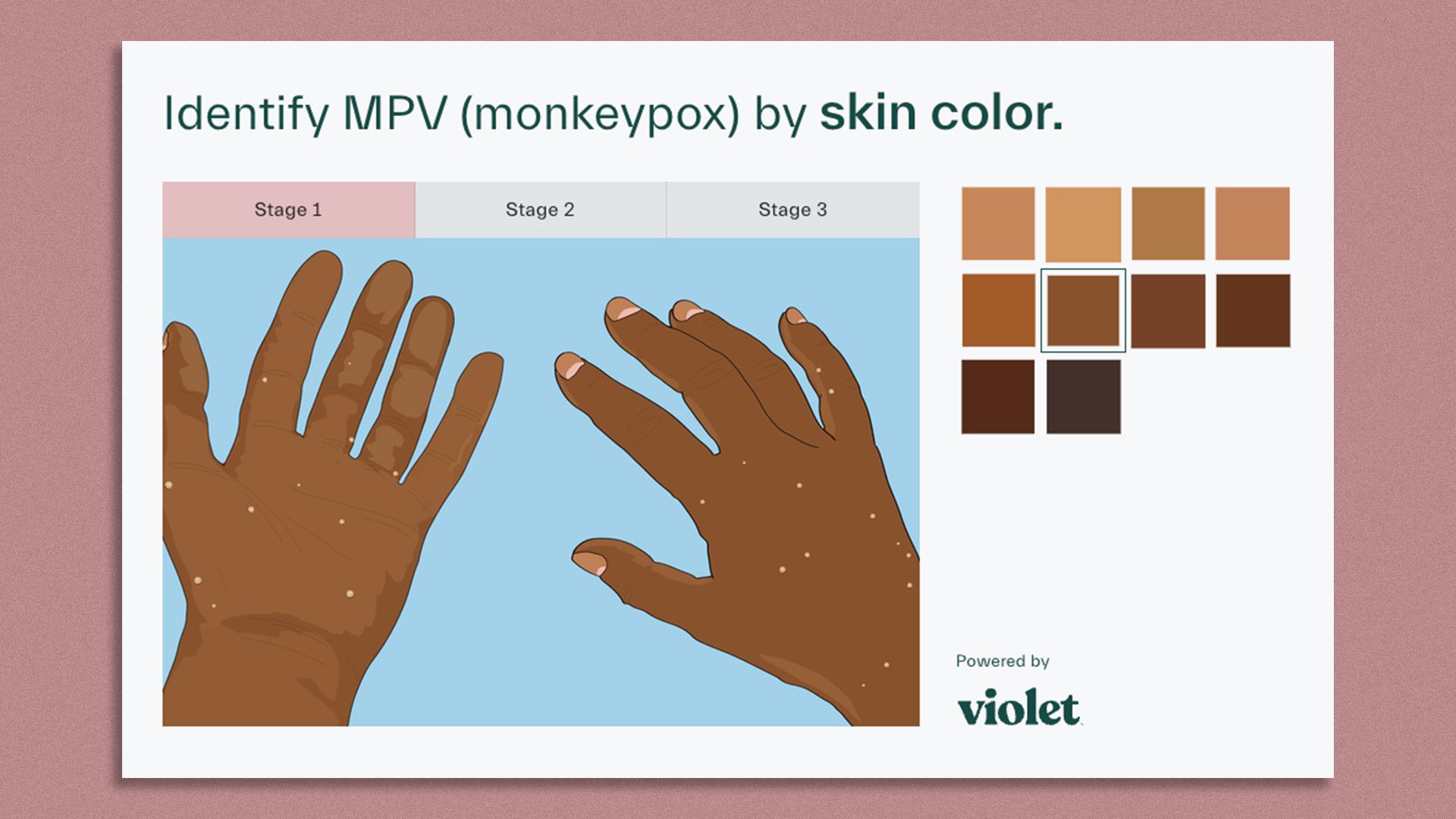 Screenshot of an image of dark skinned hands with lighter dots and a color picker tool.