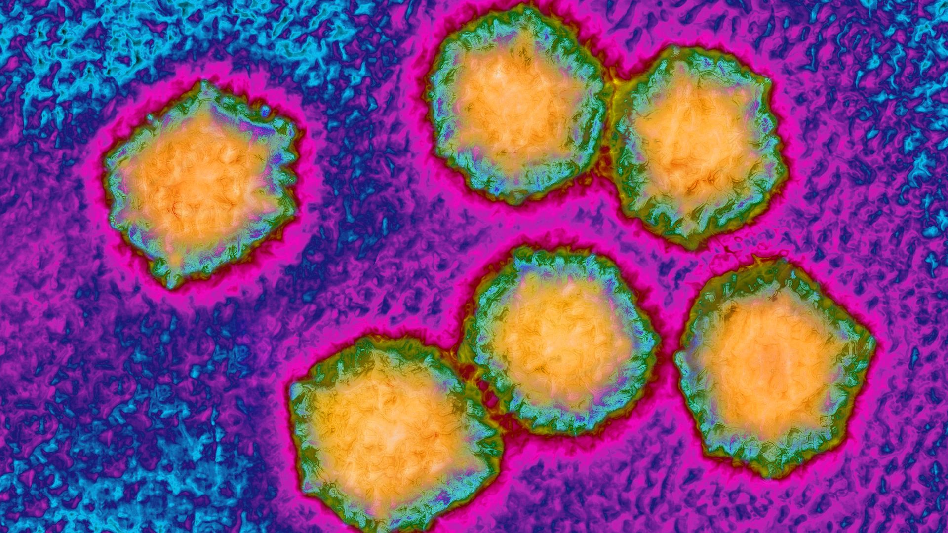 This image is a microscopic close-up of the Hepatitis A virus