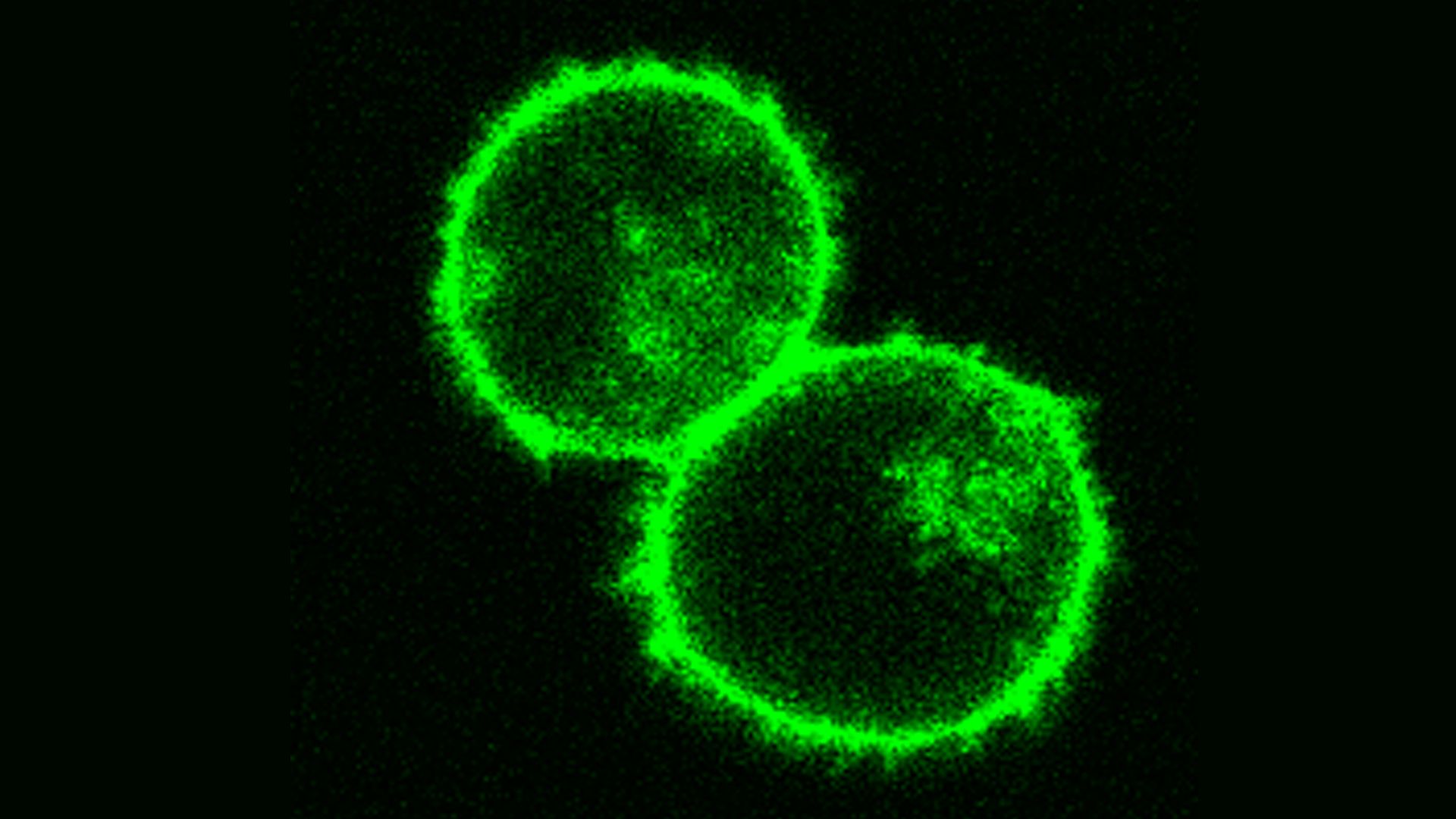 Photo of two T-cells with green fluorescent showing the gene editing targets reach the right cell.