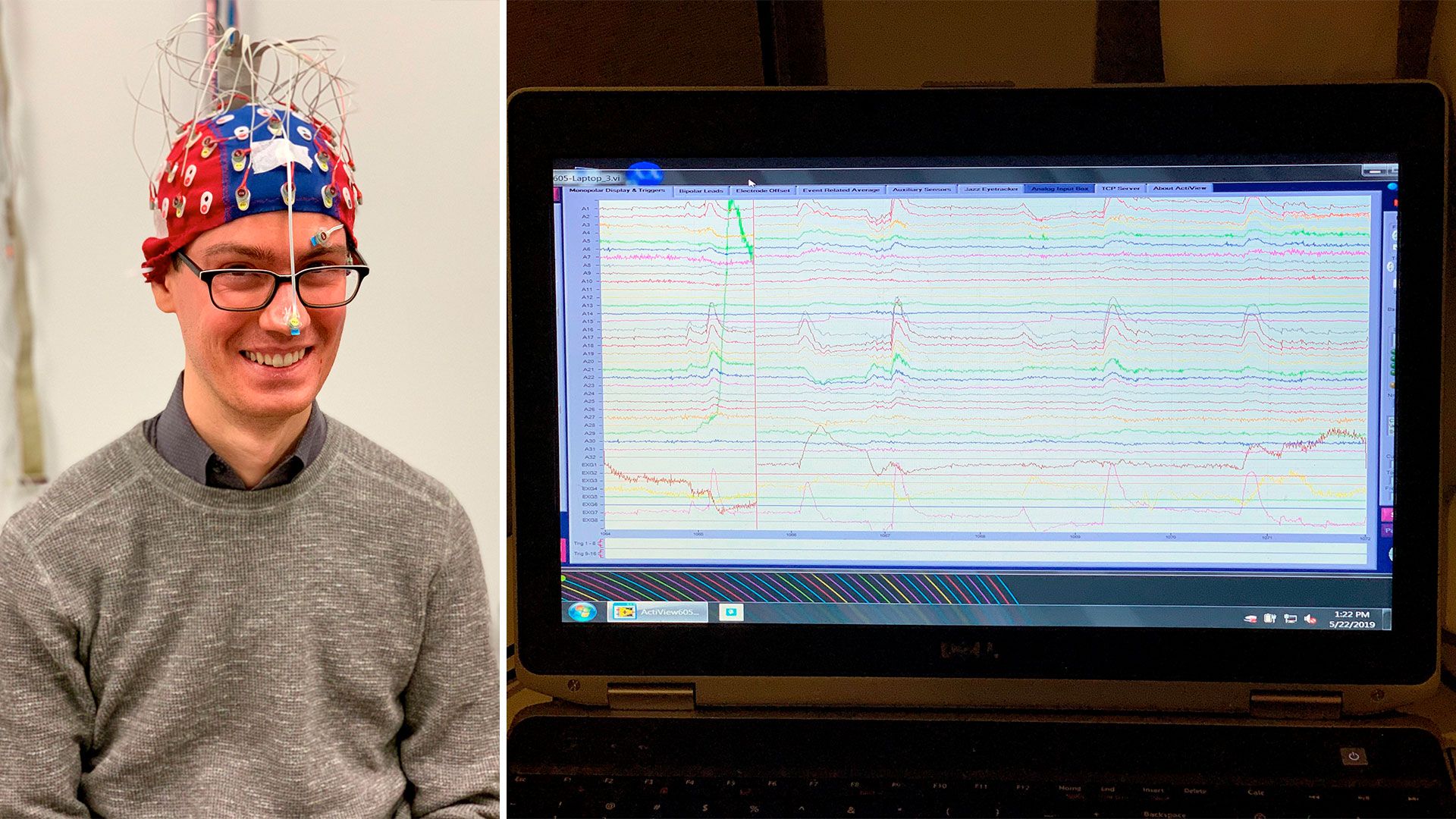 Photos of a man with a brain scan cap and a computer screen with a series of waves on it