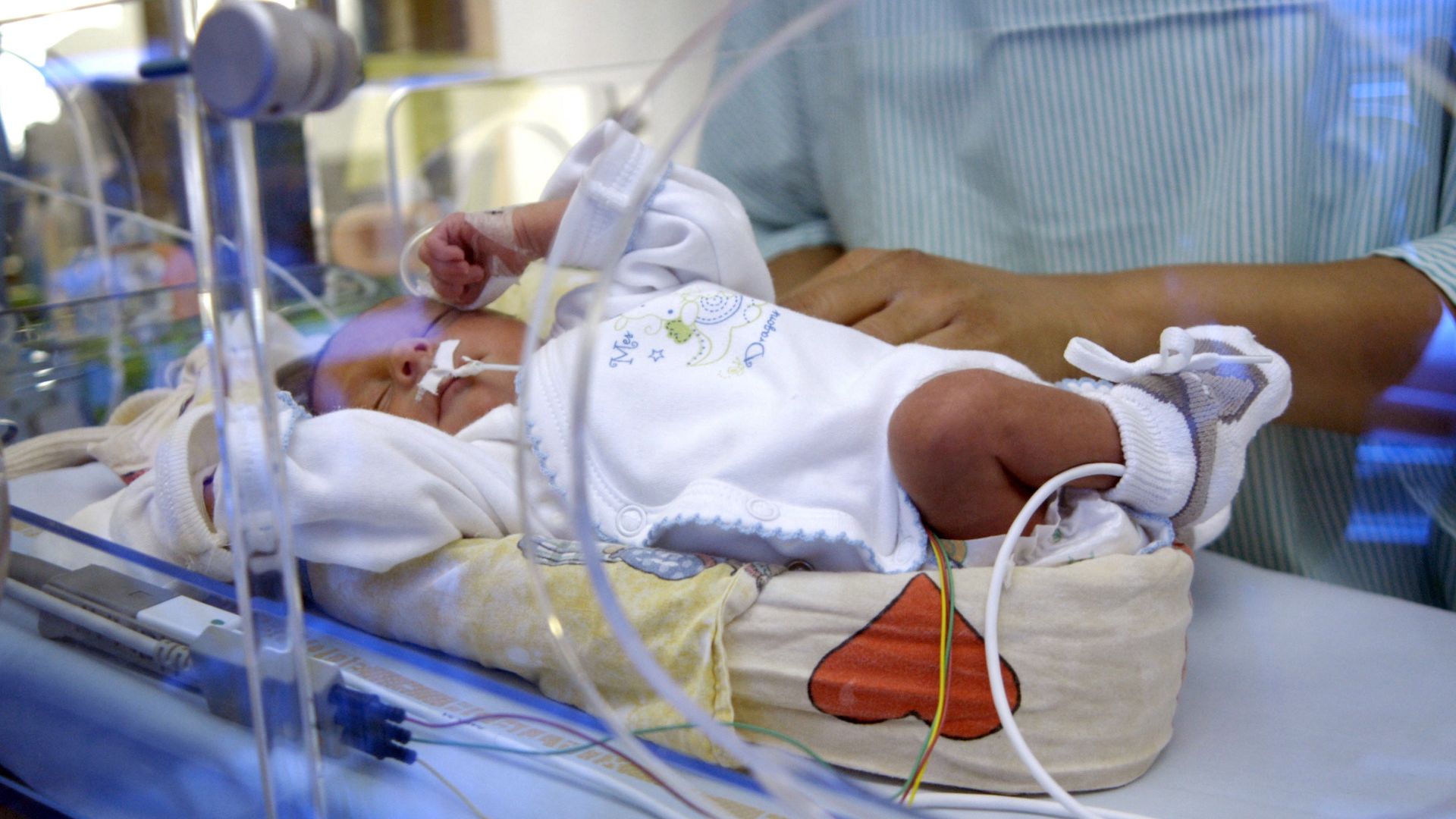Baby in a neonatal care unit in France.
