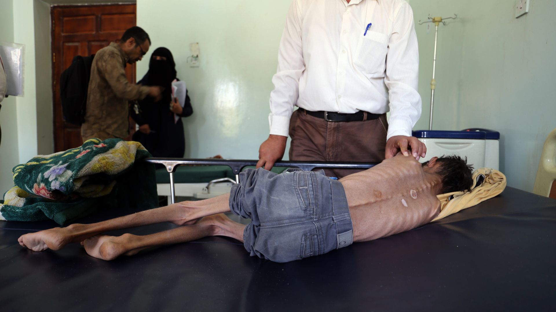 A severely malnourished boy lays in a hospital.
