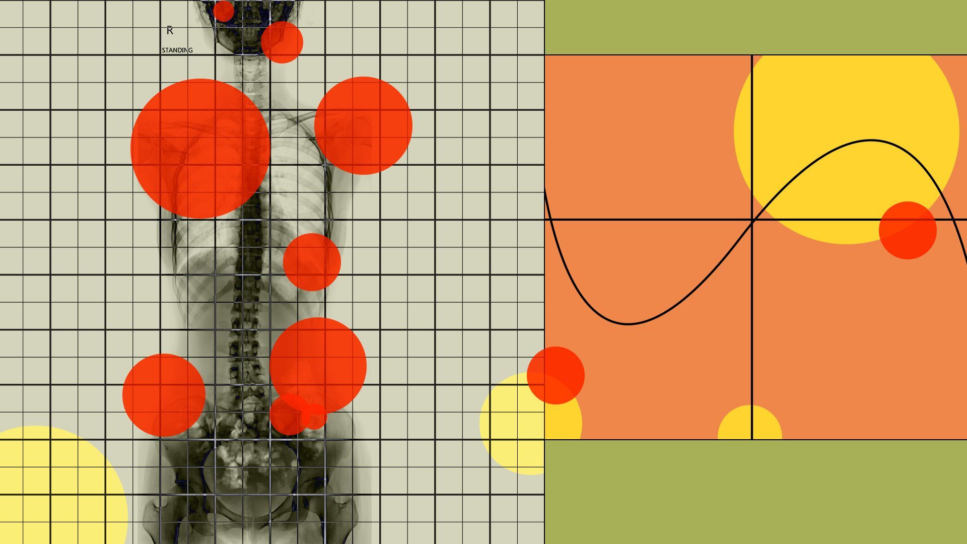 Illustrated collage of a body xray with pain points highlighted. 