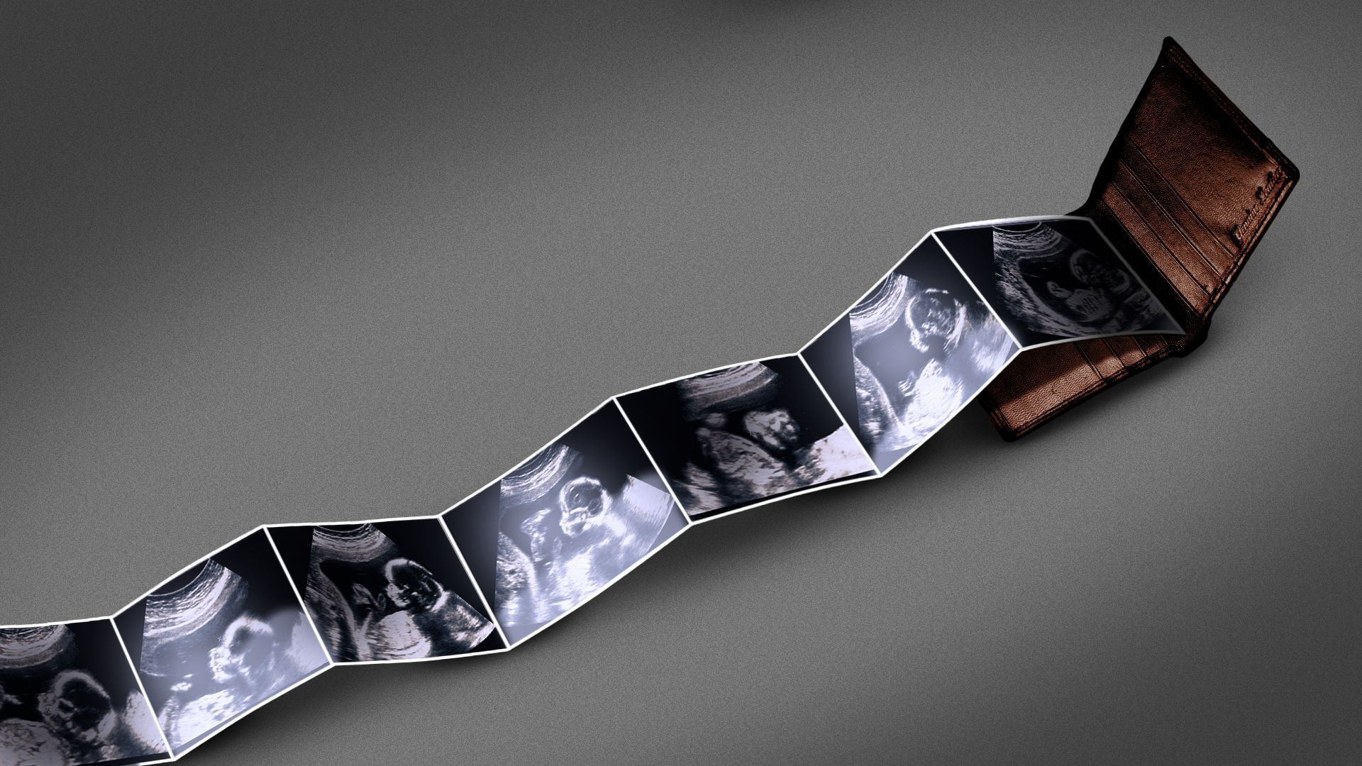 Illustration of a wallet with an accordion fold of photos showing multiple ultrasound photos. 