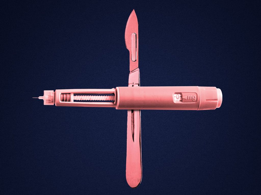 Bariatric surgery found more cost-effective than GLP-1s