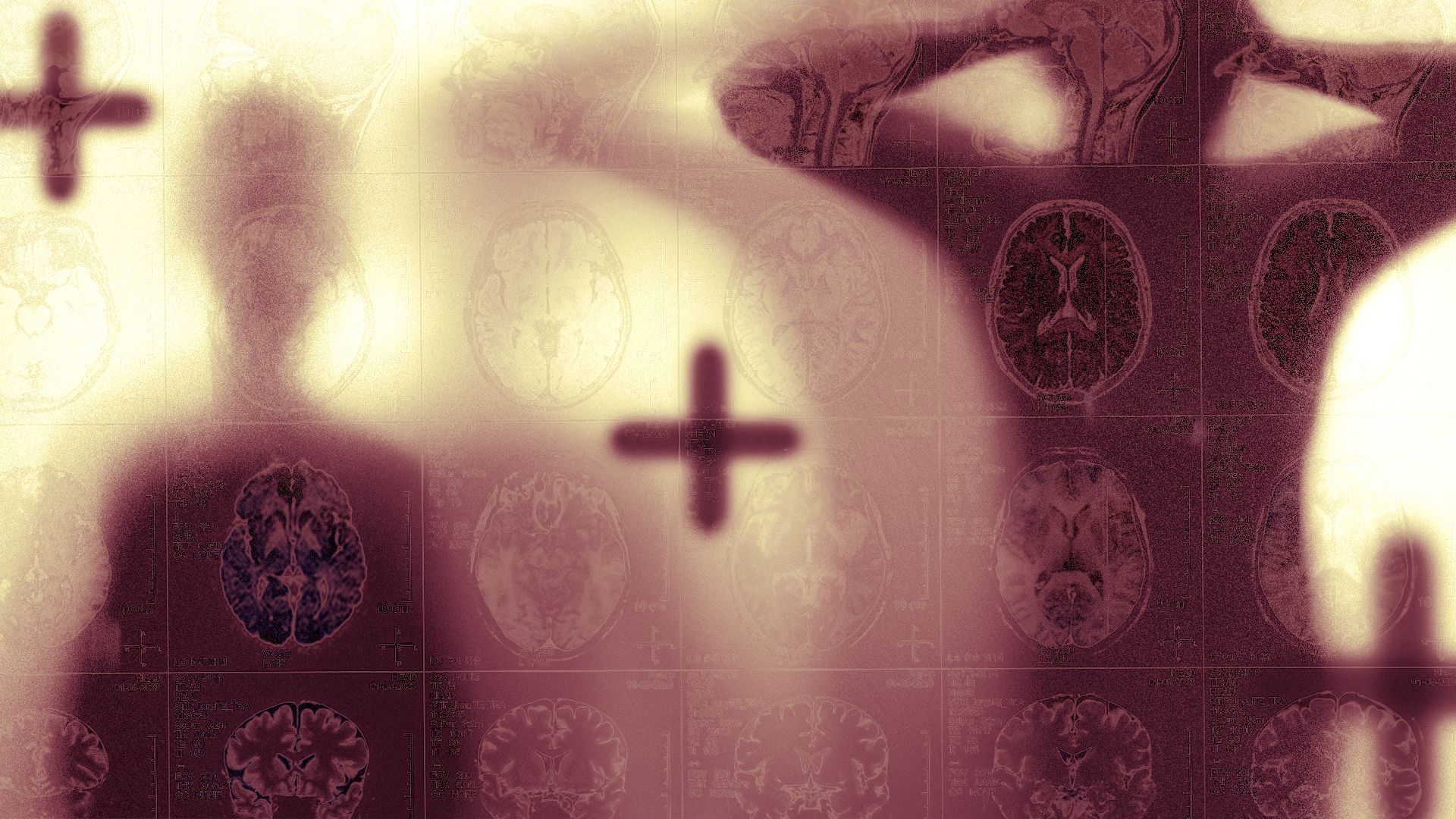 Illustration of foggy figures of a child and an adult overlaid with MRI scans and crosses.