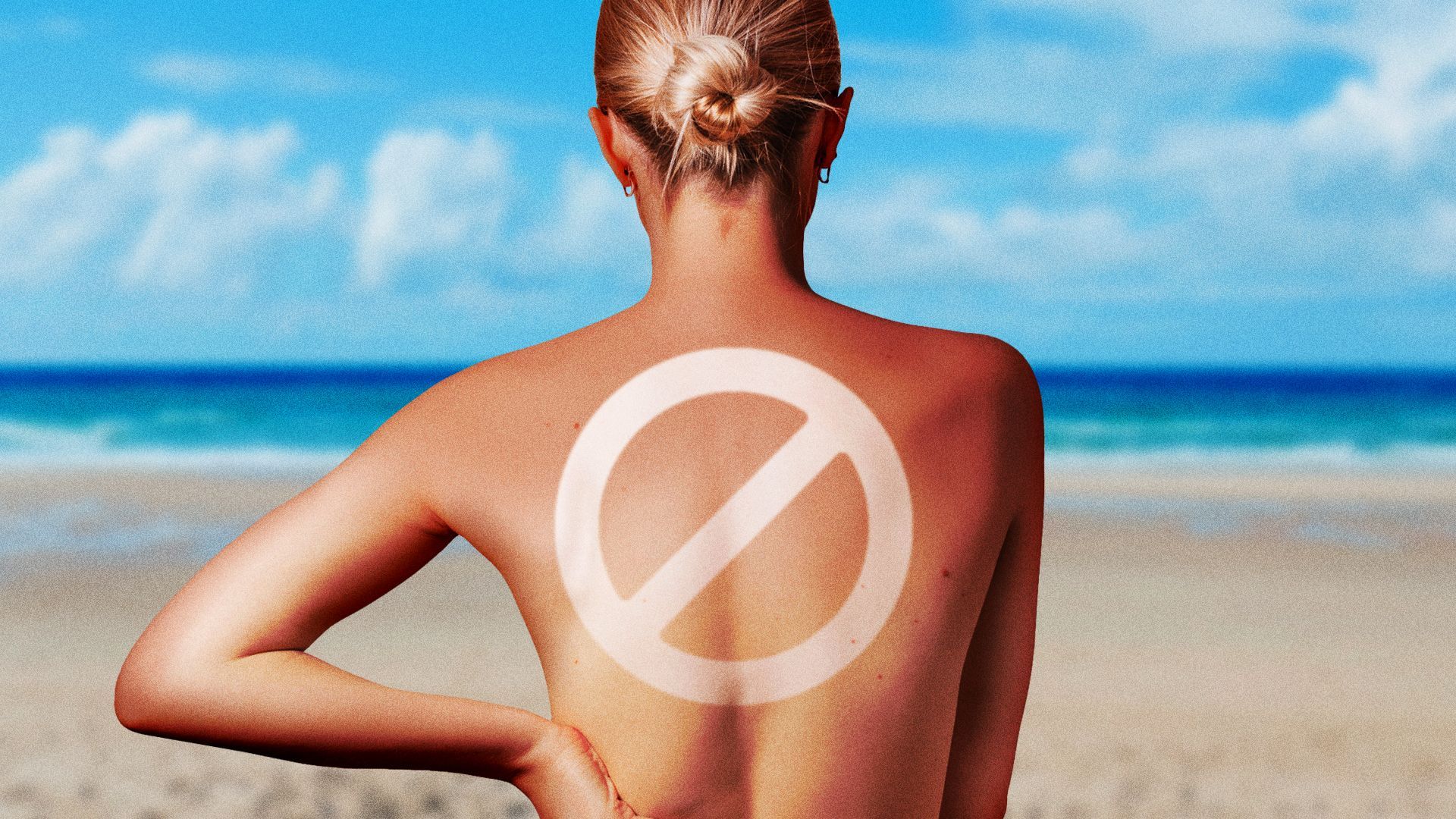 Illustration of a no-symbol being formed from tan lines on a woman's back at the beach. 