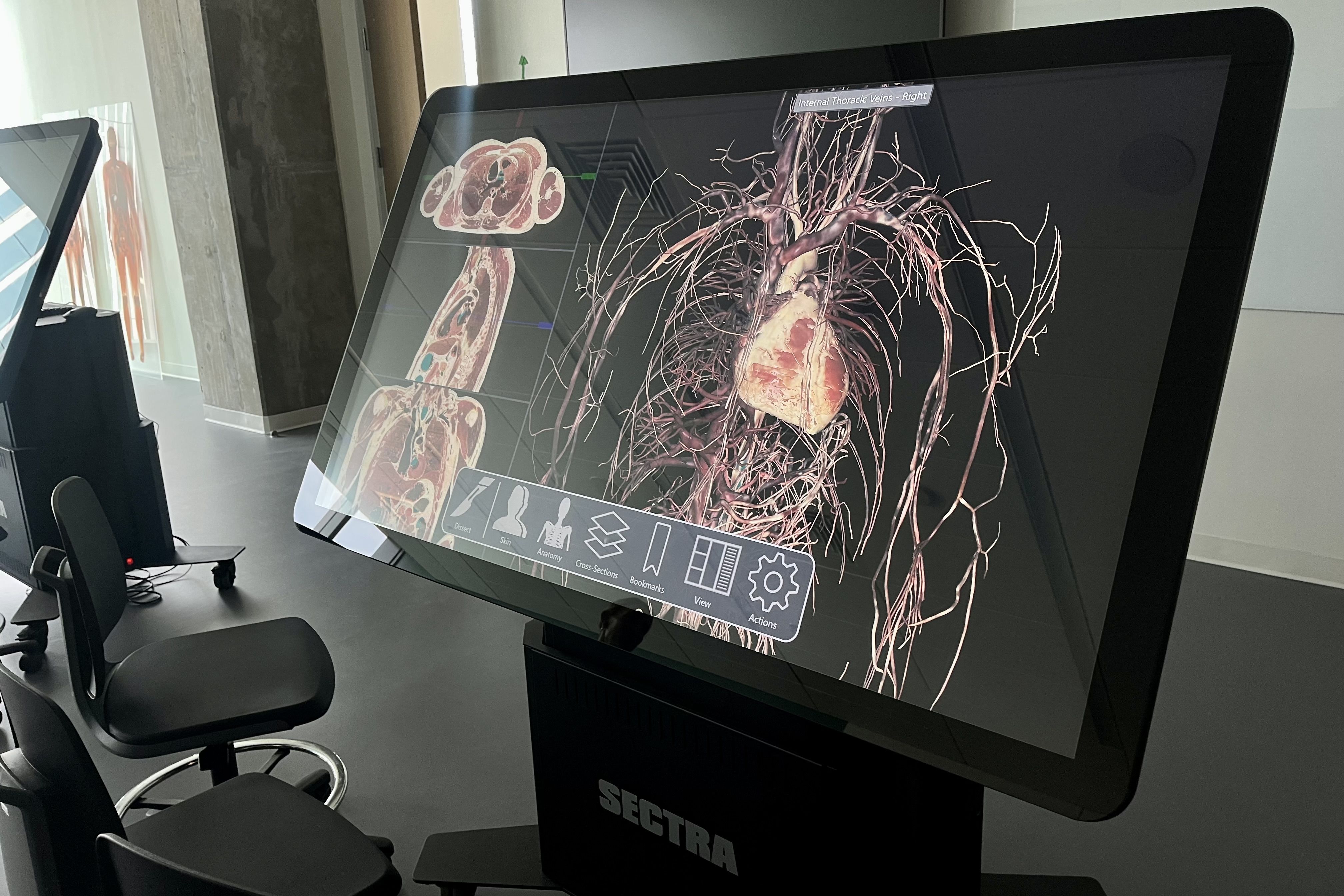 A screen with the human body