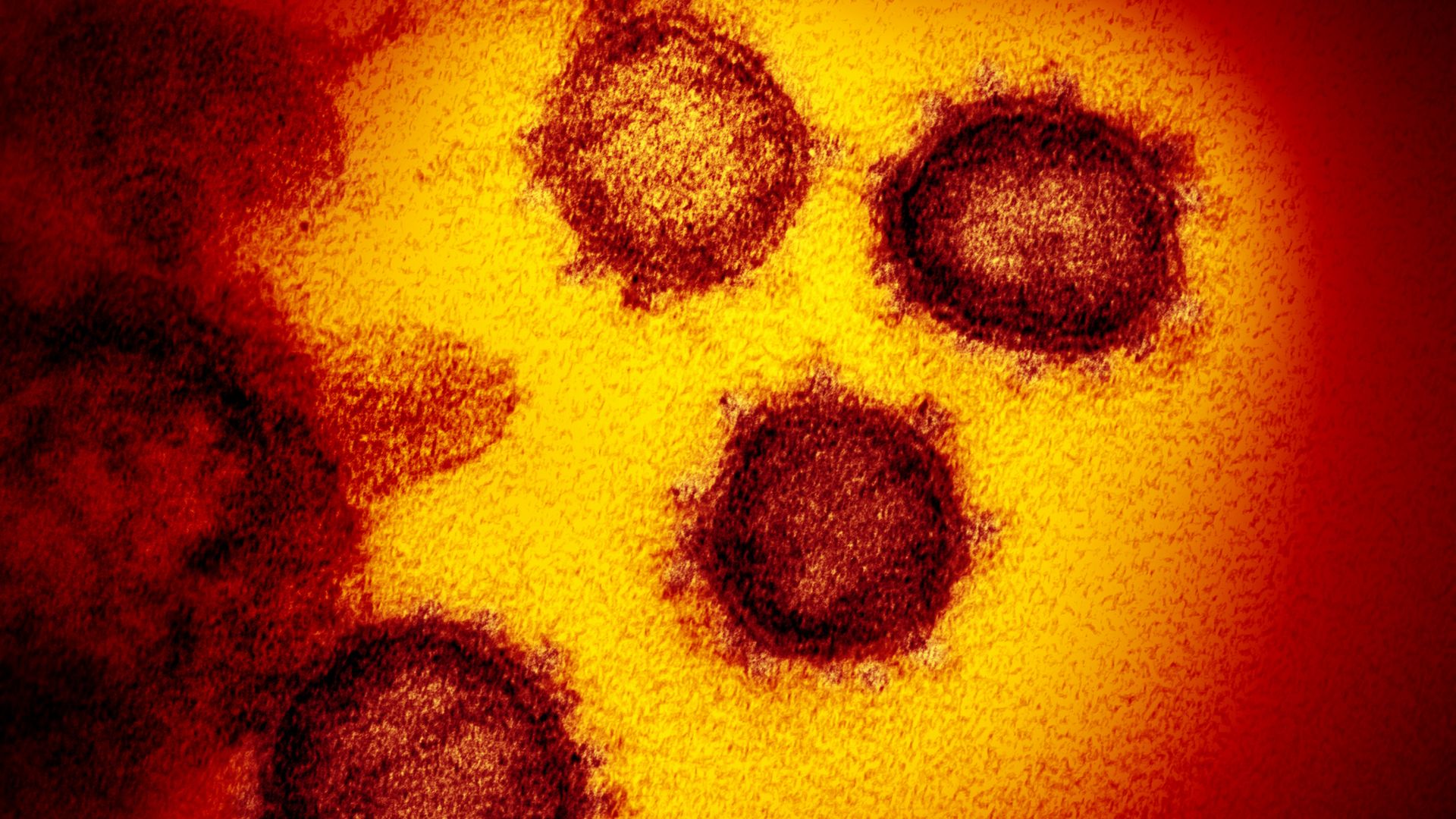 This is a close-up of the coronavirus under a microscope