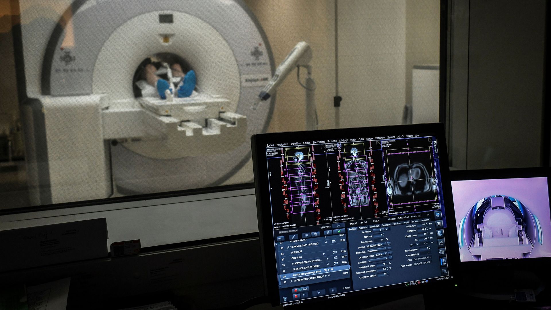 Patient undergoes MRI scan