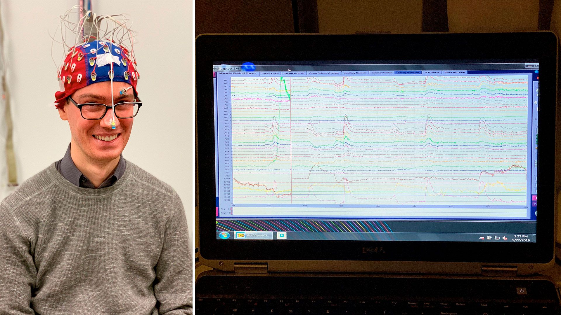 Photo of a man wearing a cap with wires next to a photo of a brain scan on a computer screen