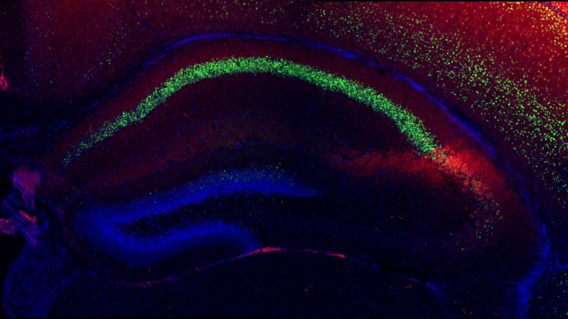 the CA2 region of the hippocampus in a mouse pup