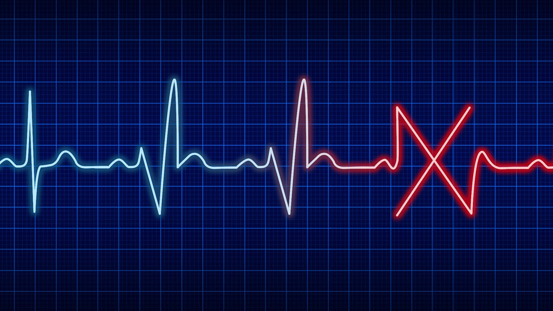 Illustration of an EKG wave resembling blue check marks followed by a red "x."