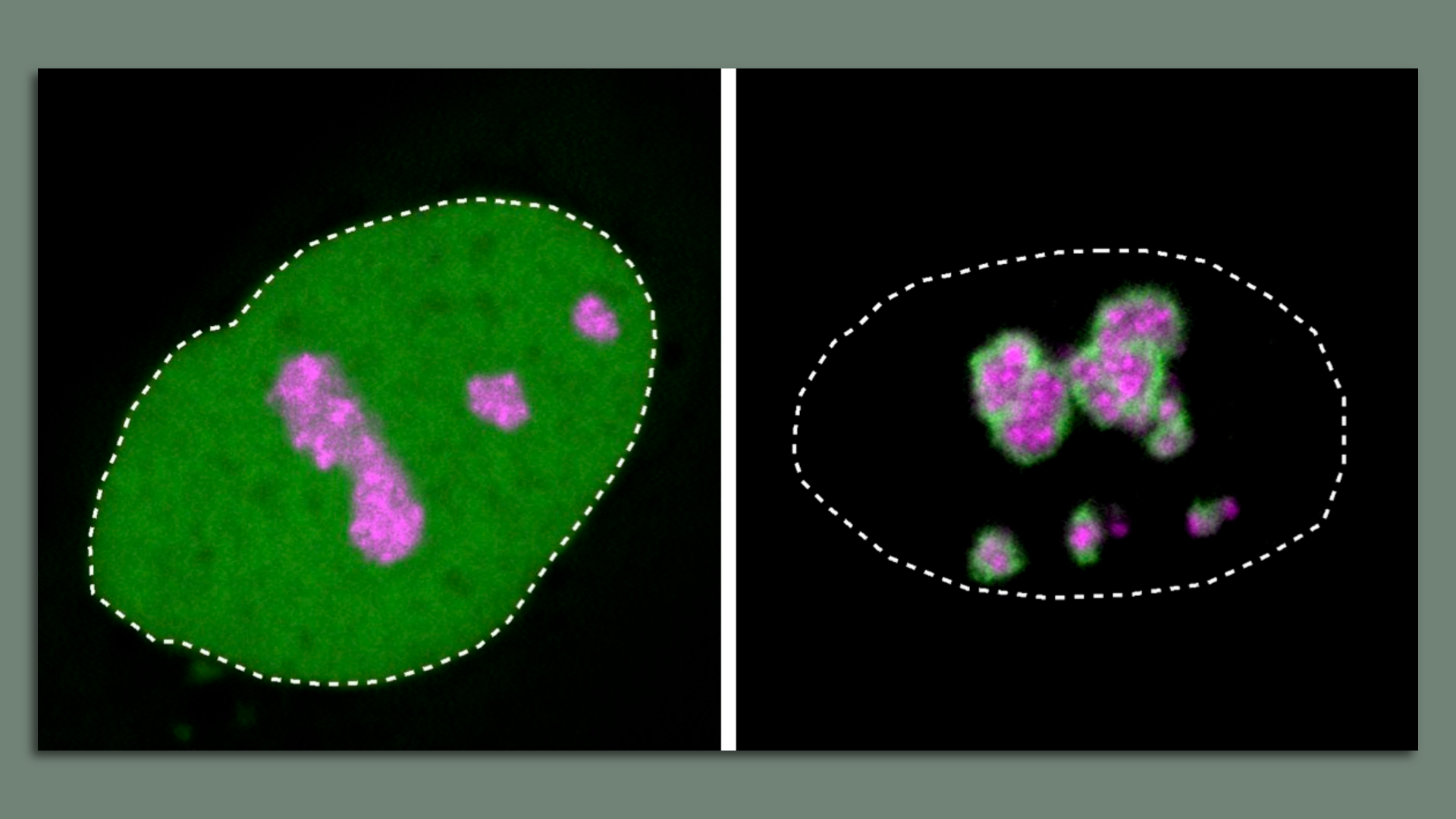 microscope image of proteins in nucleolus and not