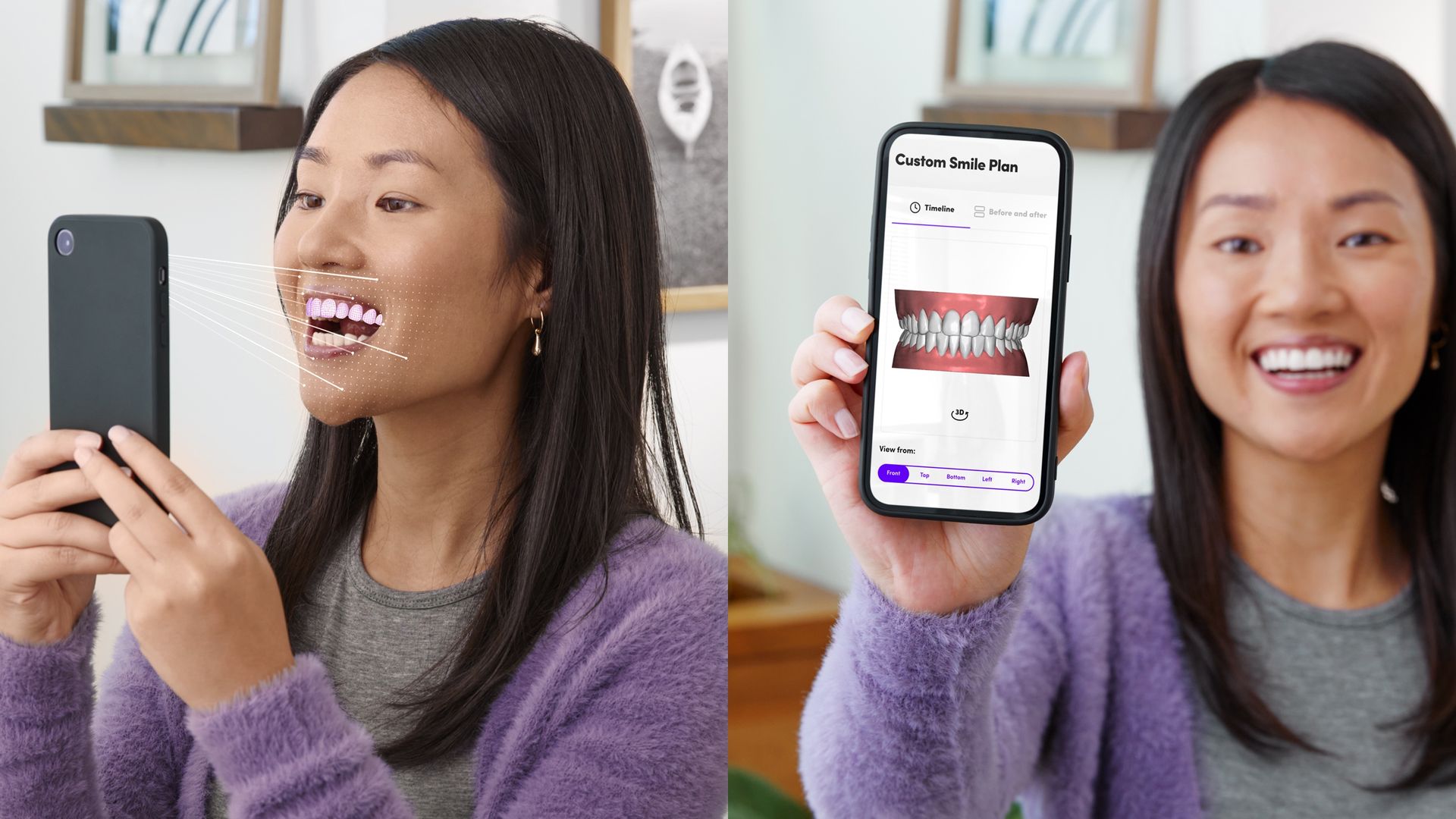 A woman points a phone at her face to scan her teeth