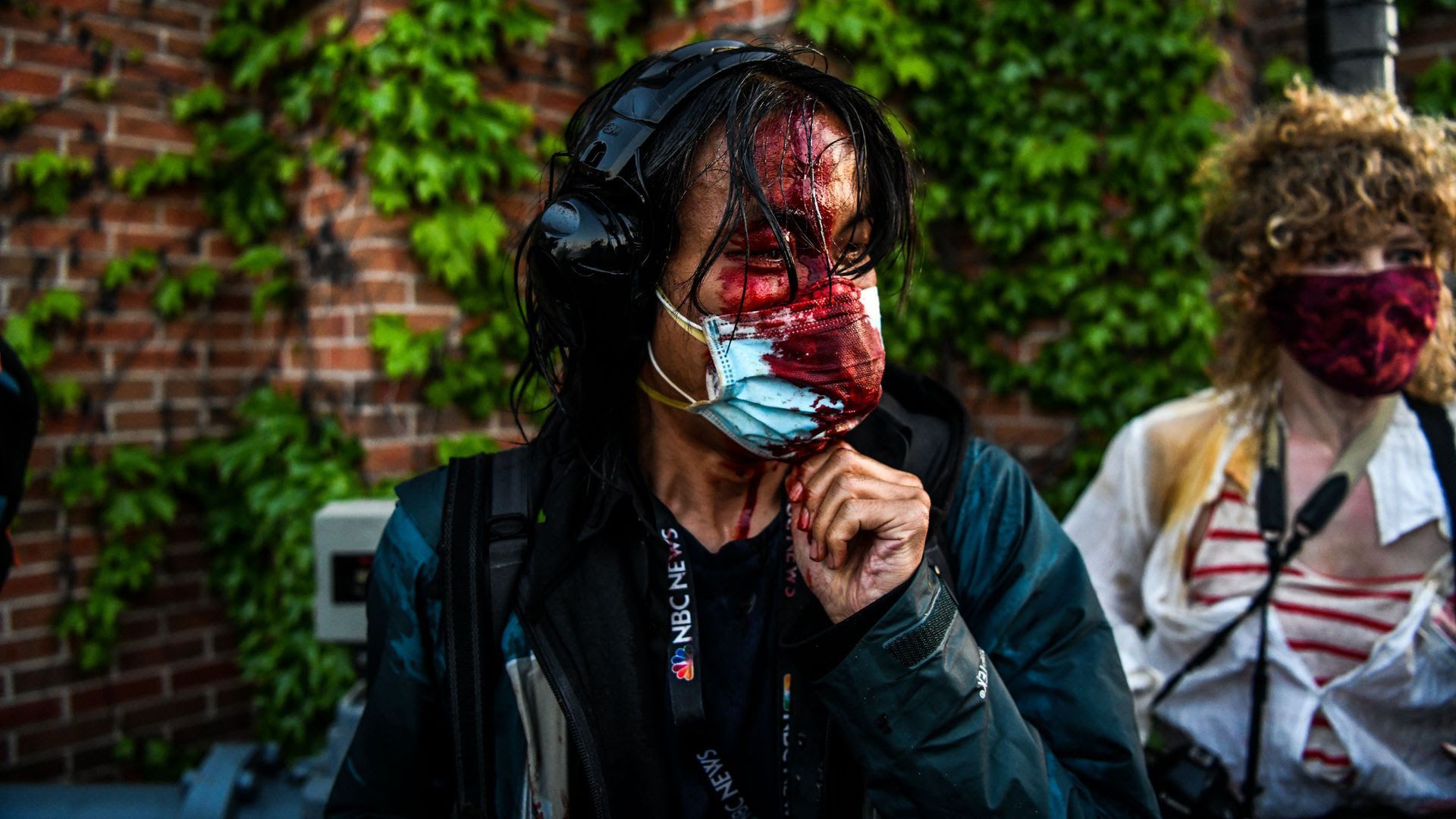 A journalist bleeding after police started firing tear gas and rubber bullets in Minneapolis, Minnesota