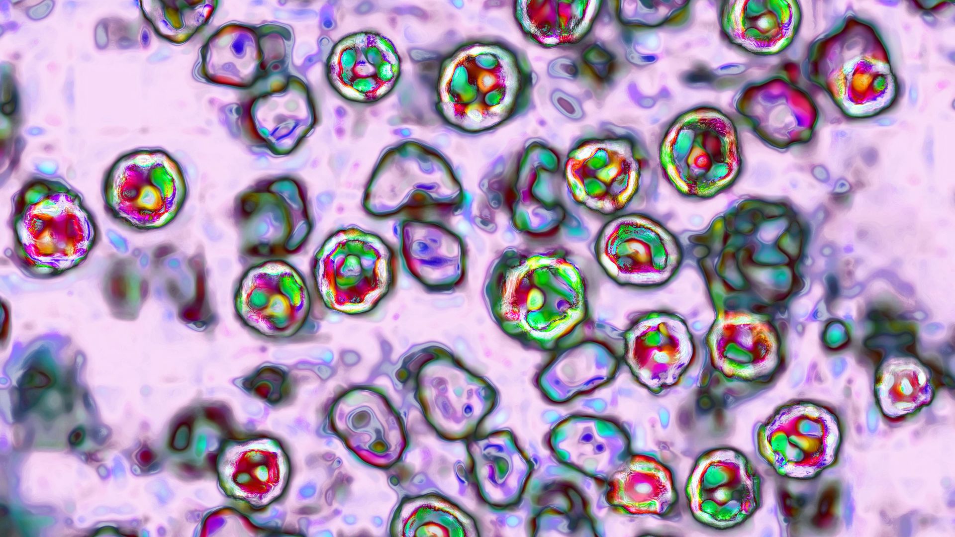 The measles virus, paramyxoviridae from the Morbillivirus family, transmission microscopy view. 