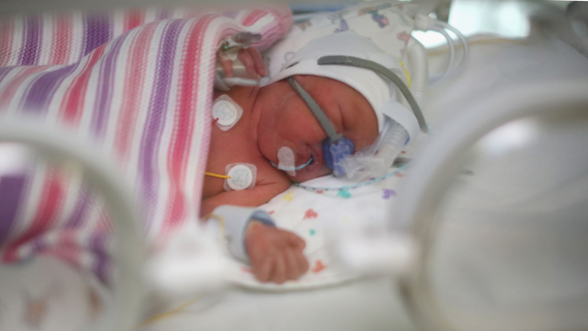 A baby in a hospital in Birmingham, England.