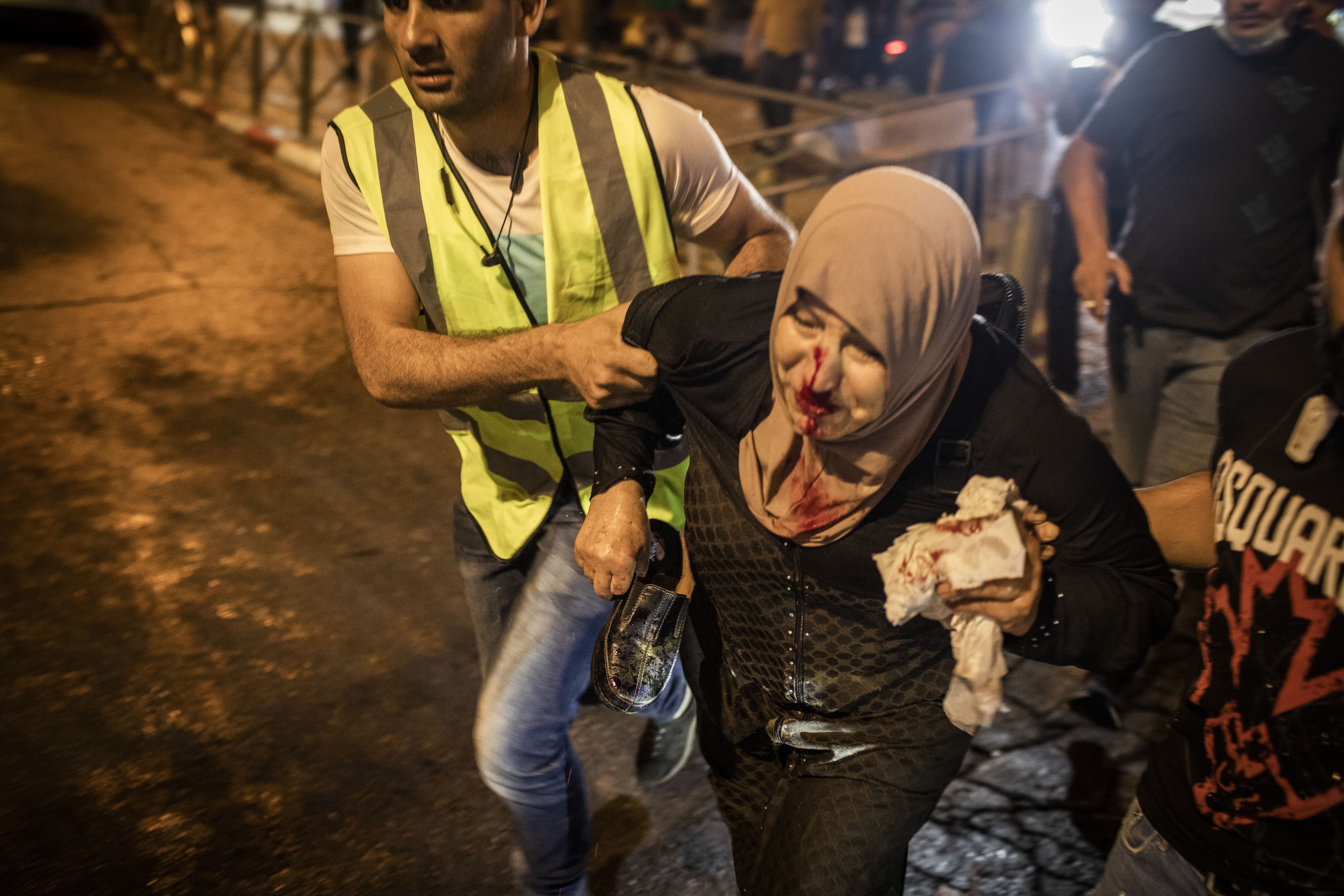 An injured woman is being helped during a demonstration against the planned eviction process for the Palestinians in the Sheikh Jarrah neighbourhood