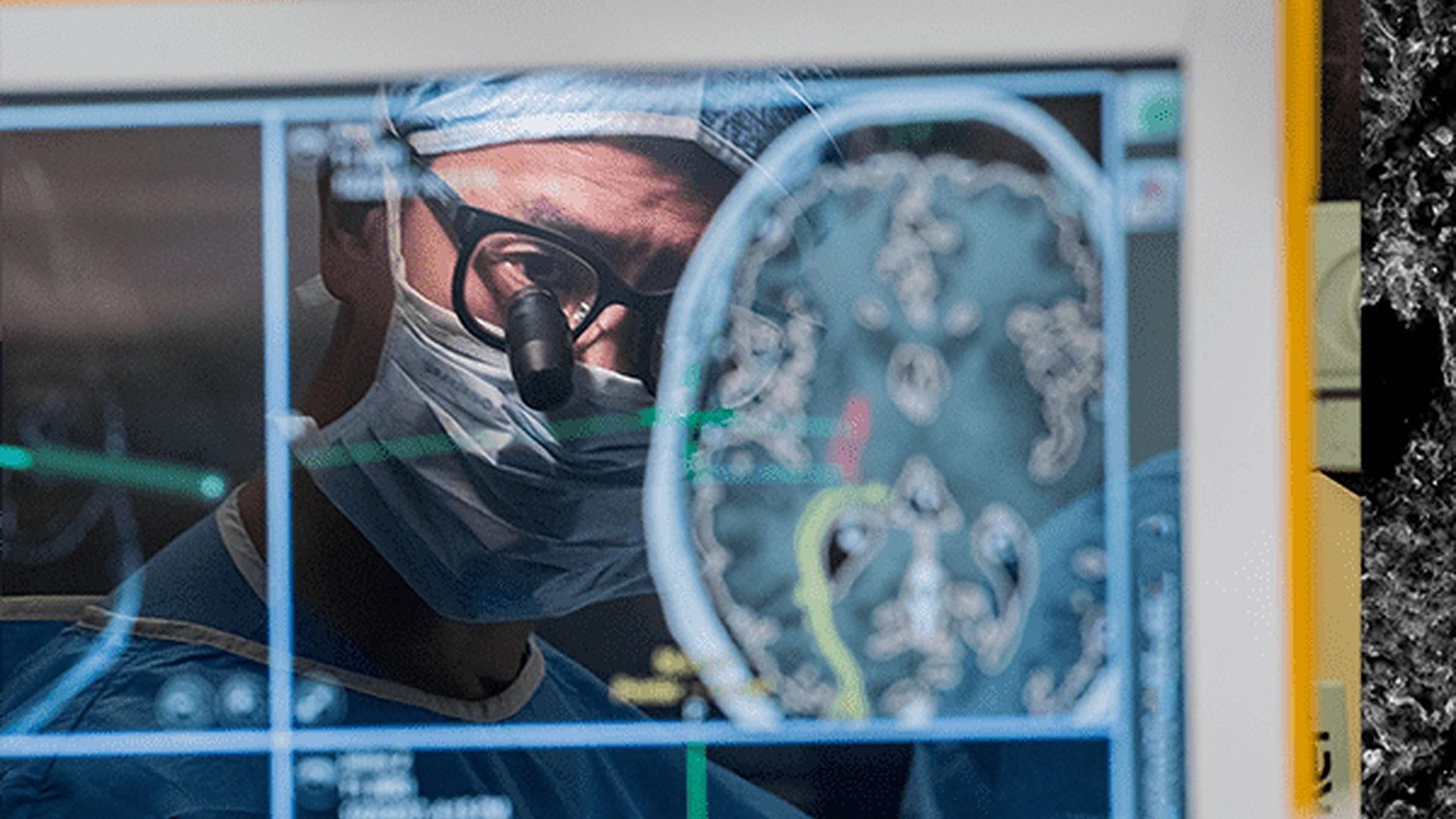 Neurosurgeon Eddie Chang performing brain surgery. 