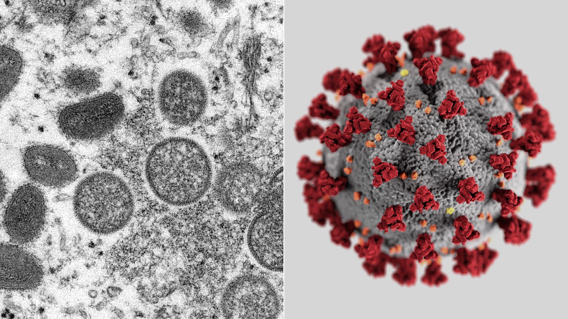 Collage of a photo of the monkeypox virus on the left side and SARS-CoV-2 on the right side.