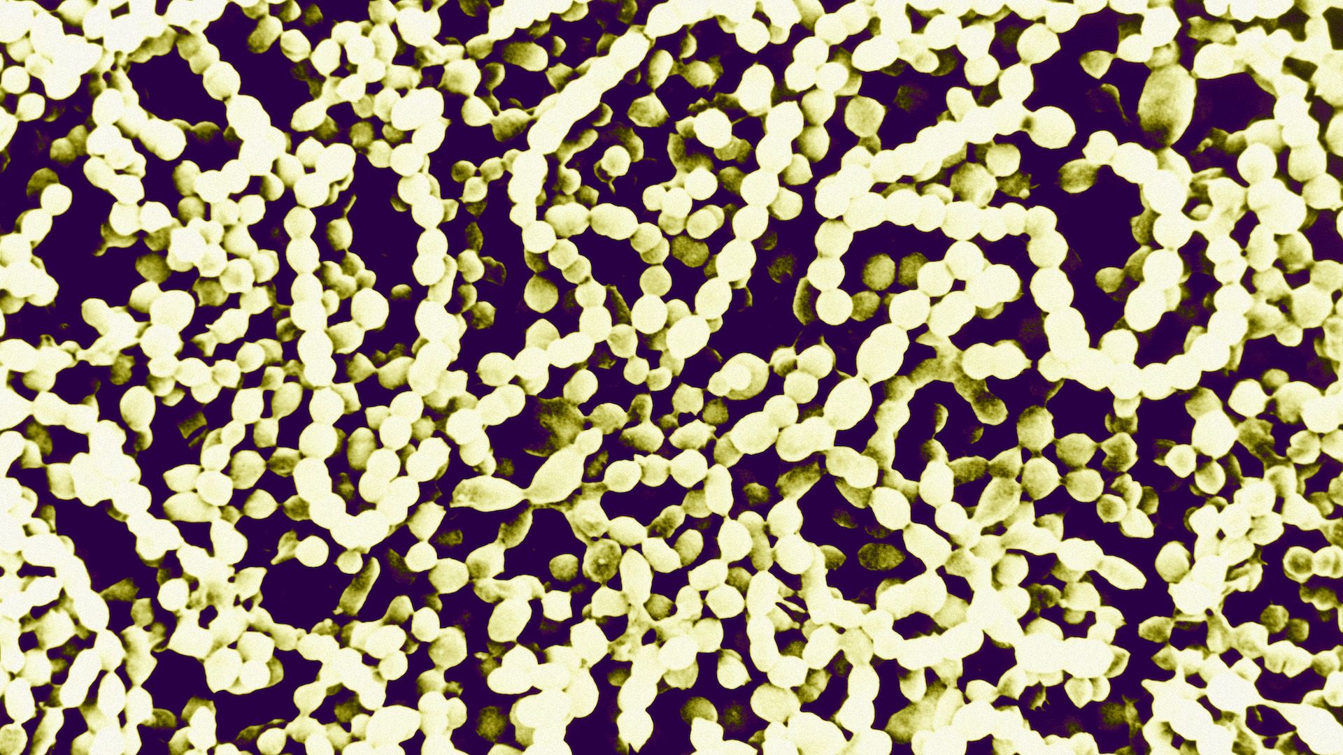 Streptococcus Pyogenes