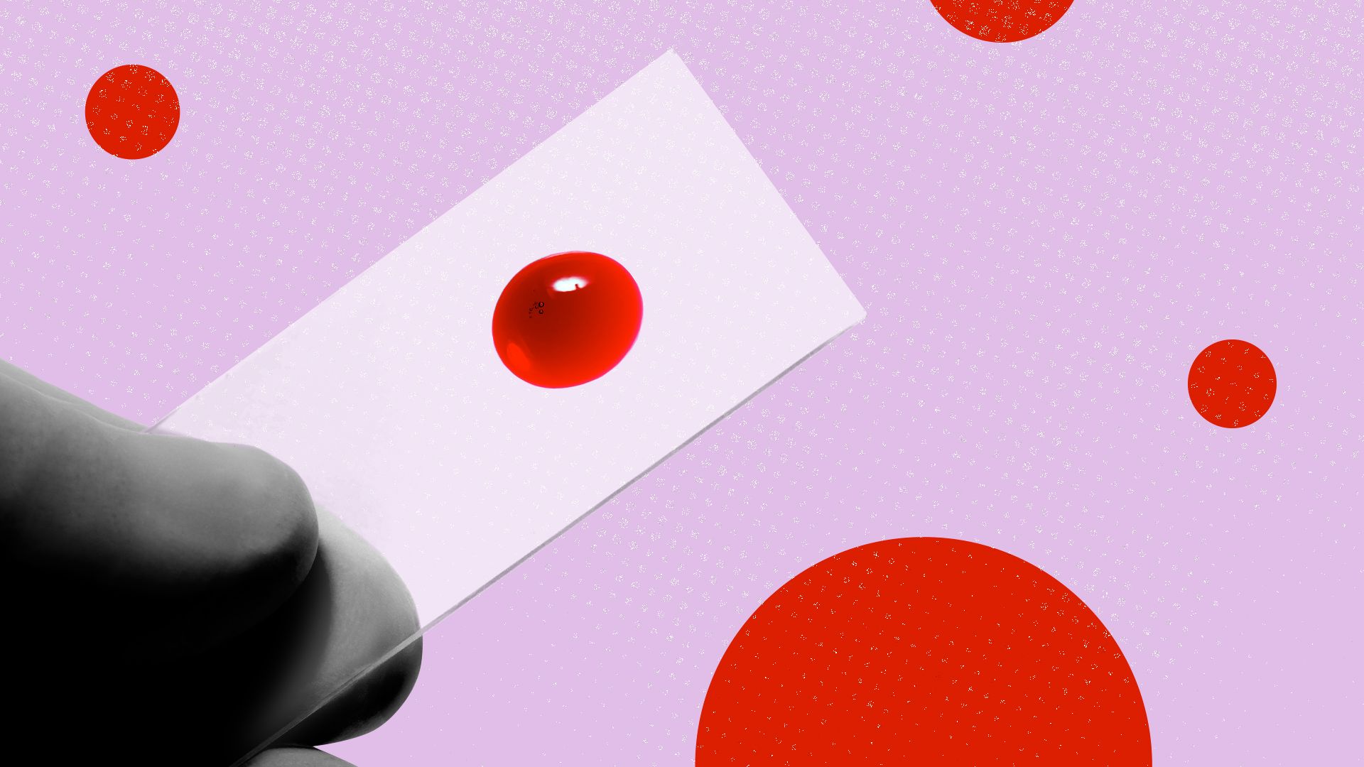 Photo collage of a hand holding a slide of a drop of blood with red circles all around.
