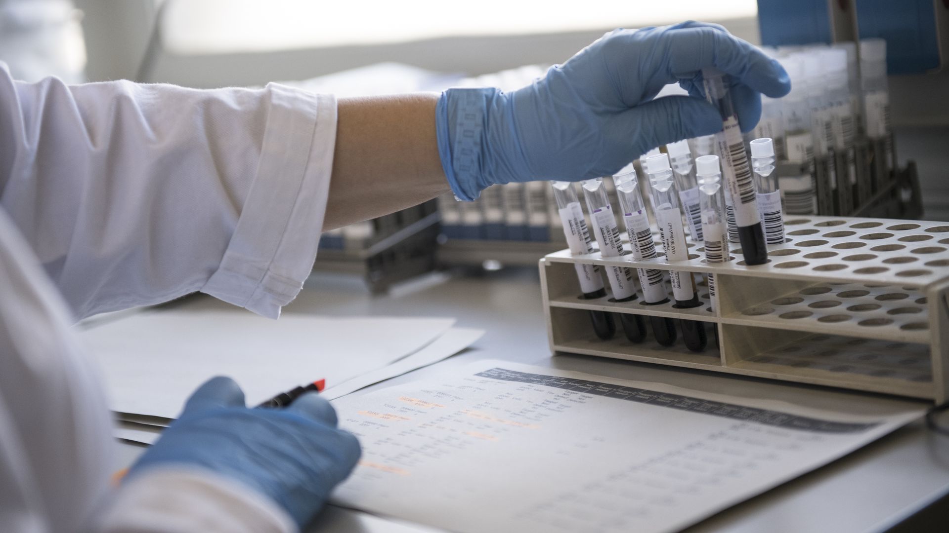 Blood and plasma samples used for the evaluation swabs for Coronavirus in the research laboratory