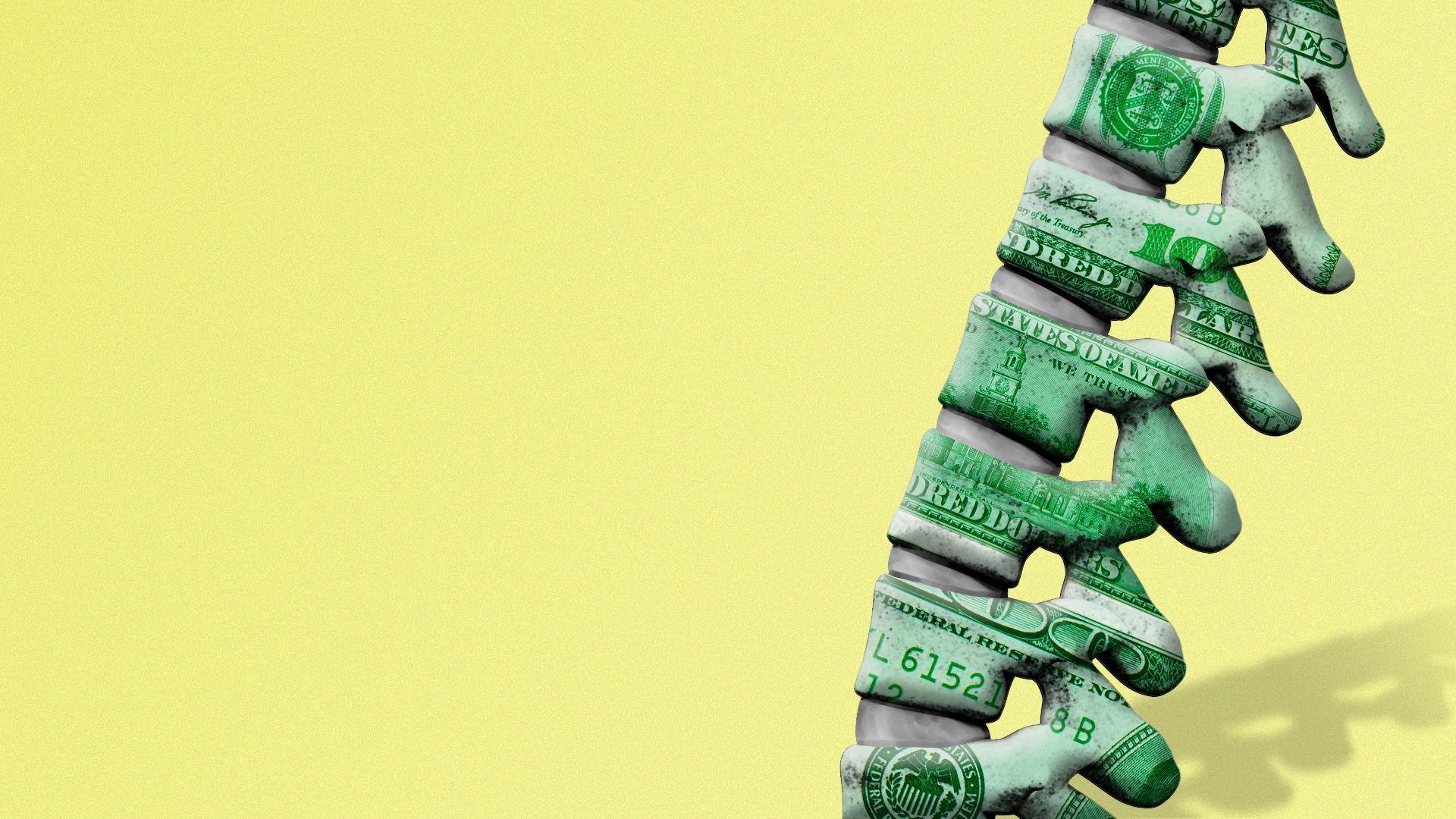 Illustration of a spine with the vertebrae made out of dollars.