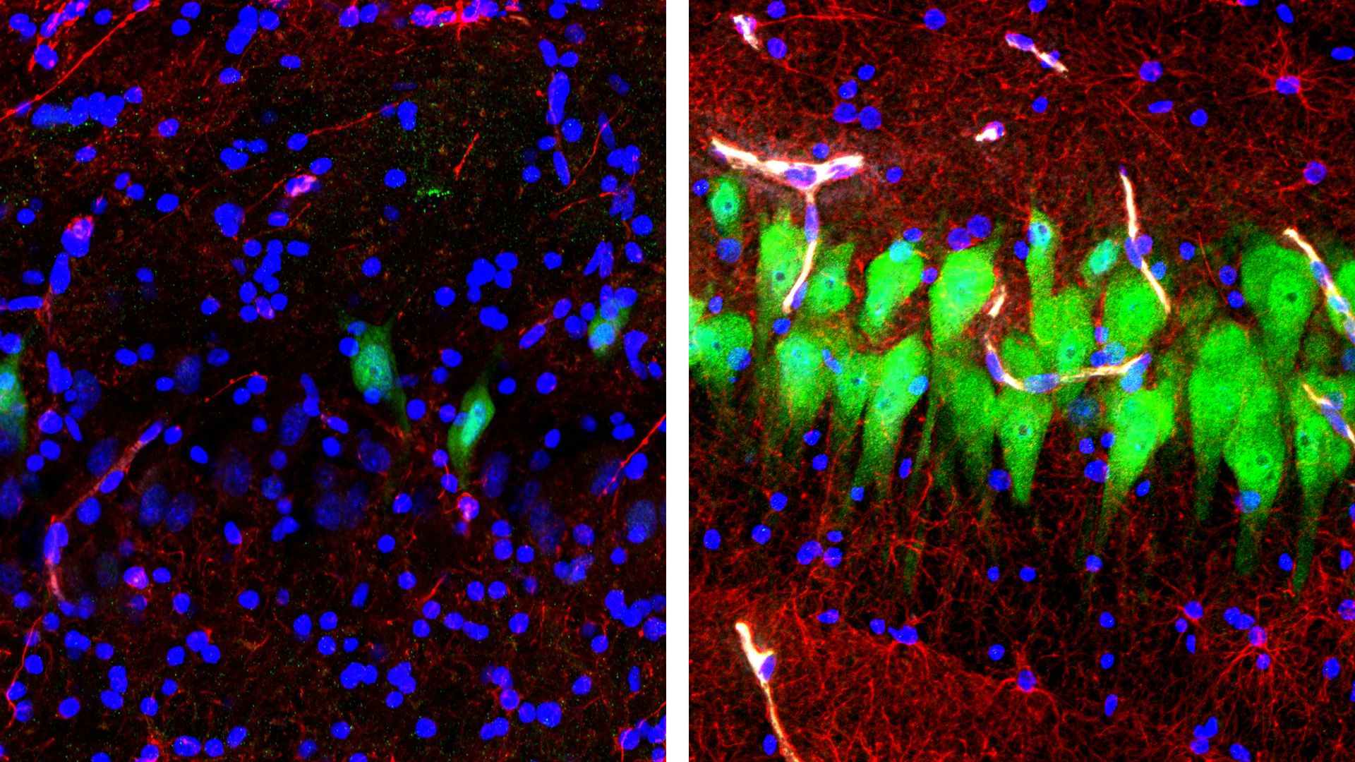 Photo of pig brain neuronal activity before and after BrainEx tool is used