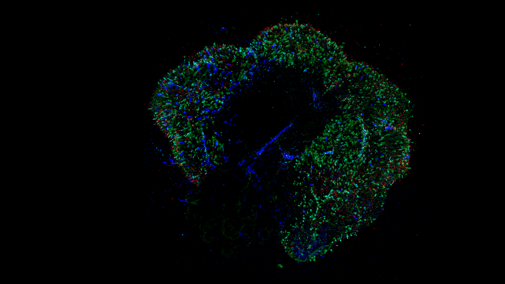 Microscopic photo of a retinal organoid that's 291 days old