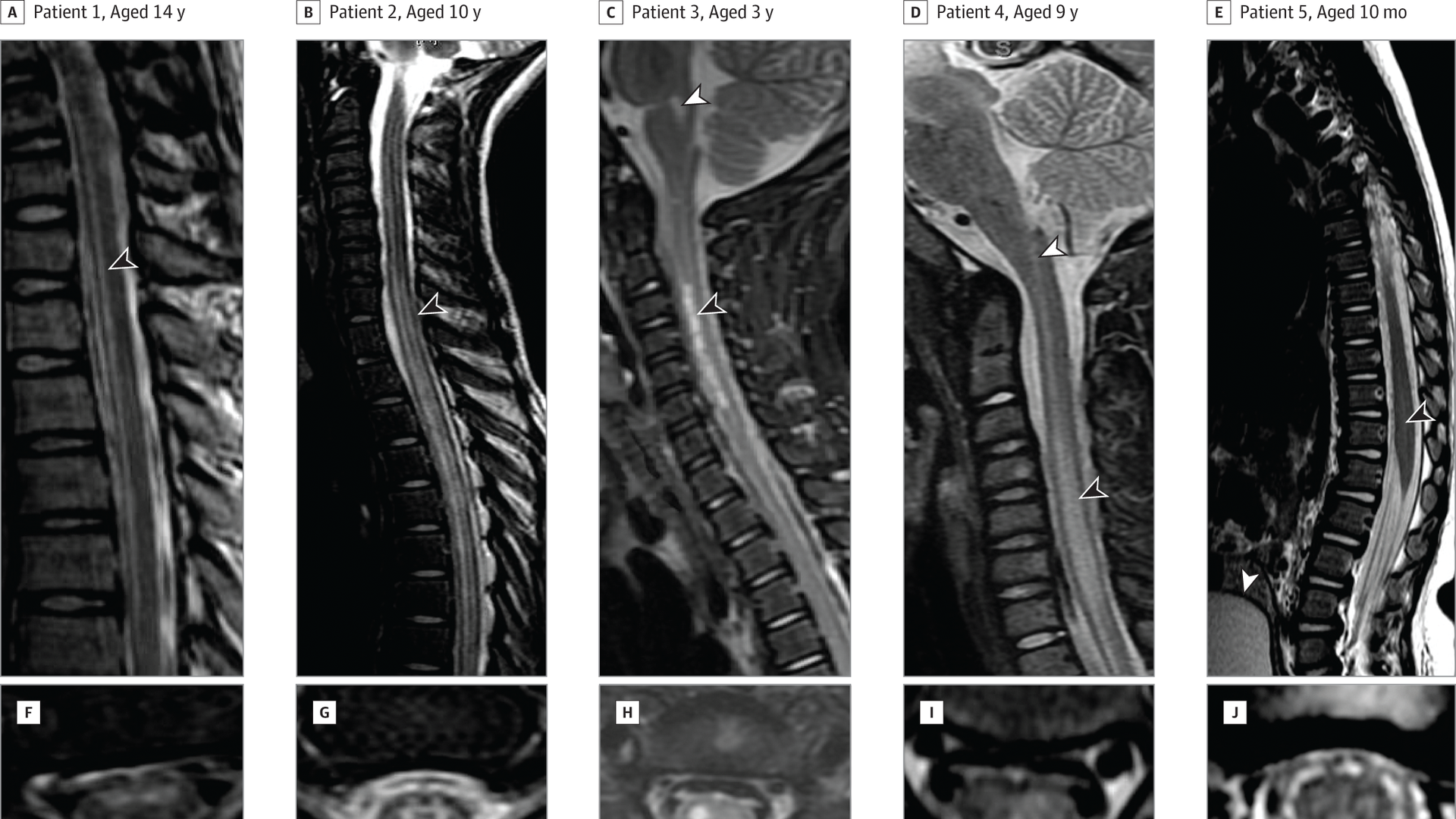 Images of spinal MRIs