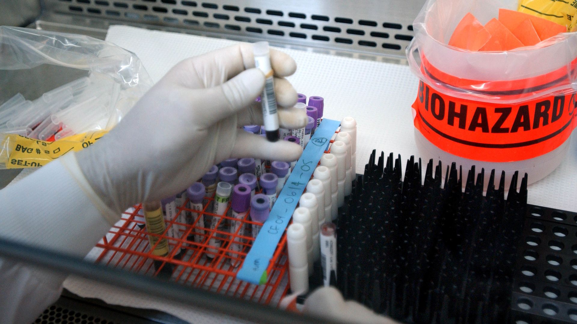 A technician performs a DNA test