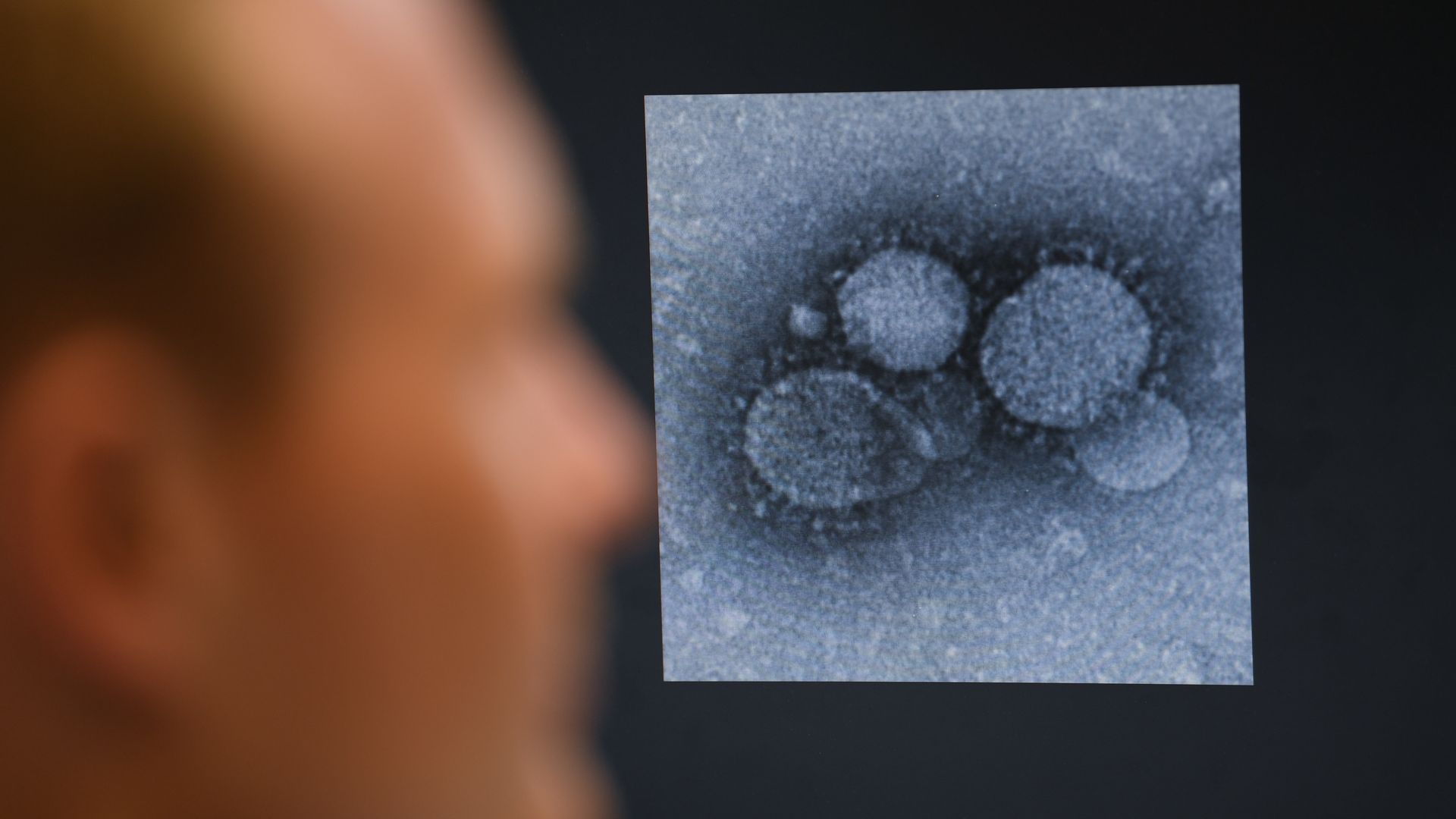 In this image, a close up of the coronavirus is displayed 
