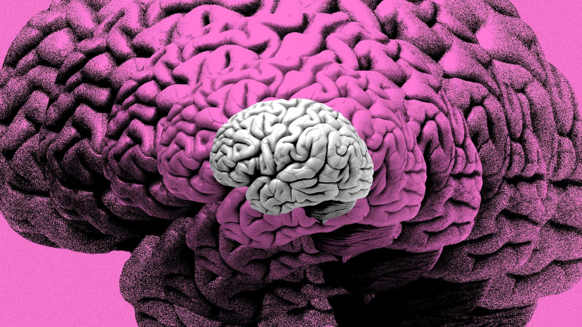 Illustration of copies of a human brain gradually becoming more distorted.