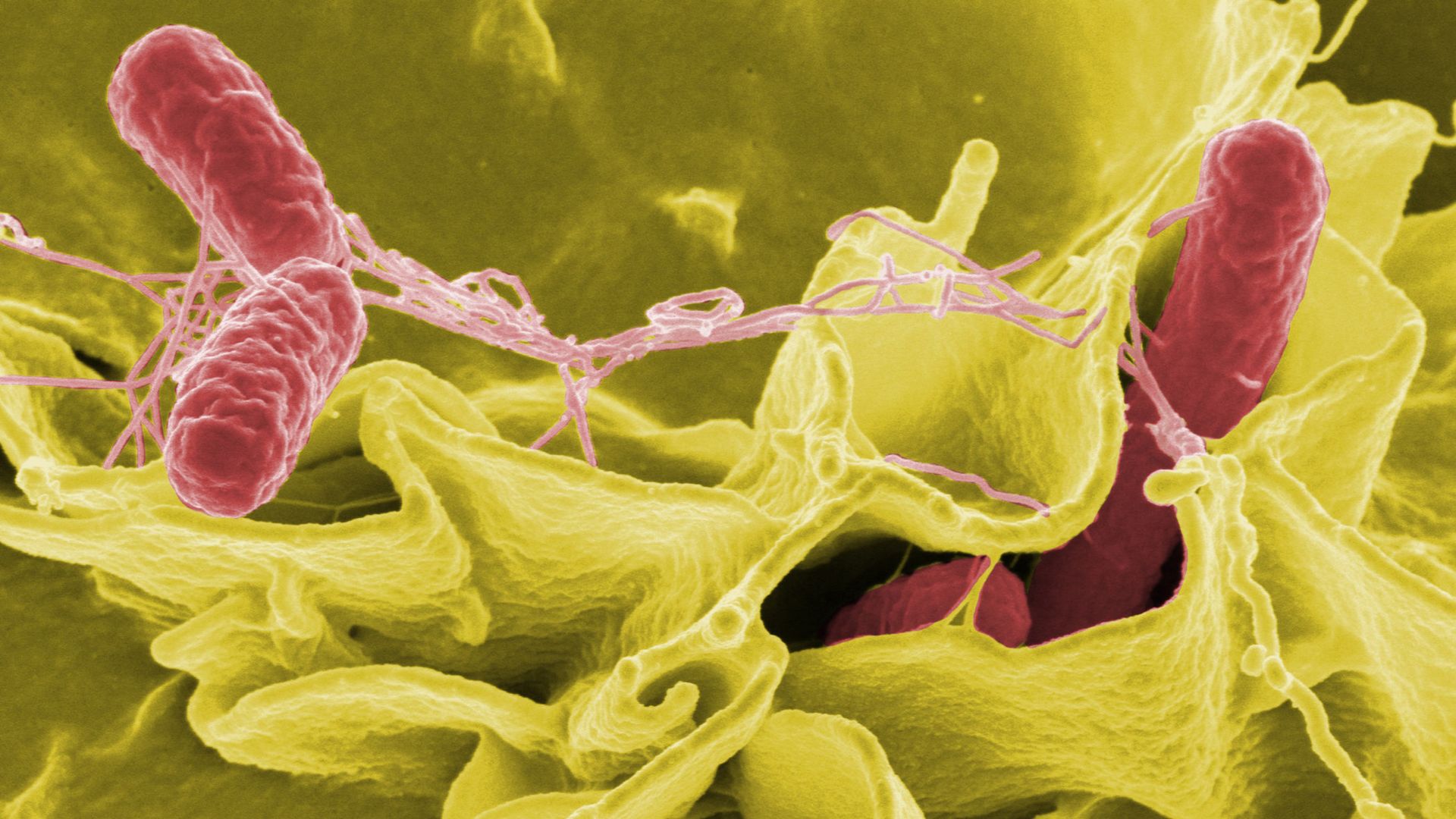 Photo of a different strain of Salmonella as it invades cultured human cells