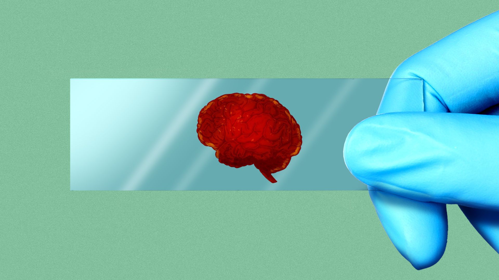 Illustration of a hand in a plastic glove holding a glass slide with a blood sample in the shape of a brain
