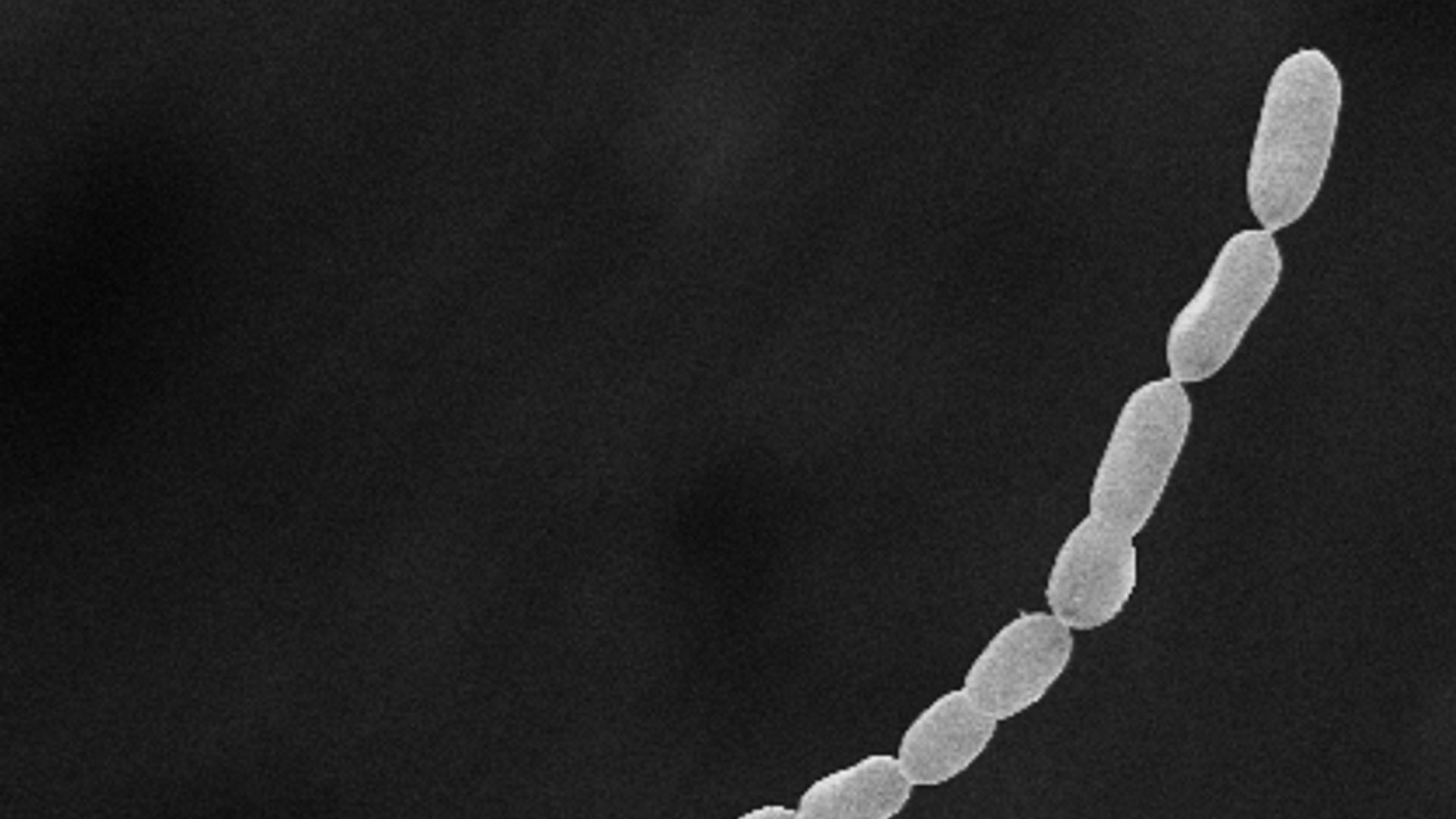 Filaments of Thiomargarita magnifica. 