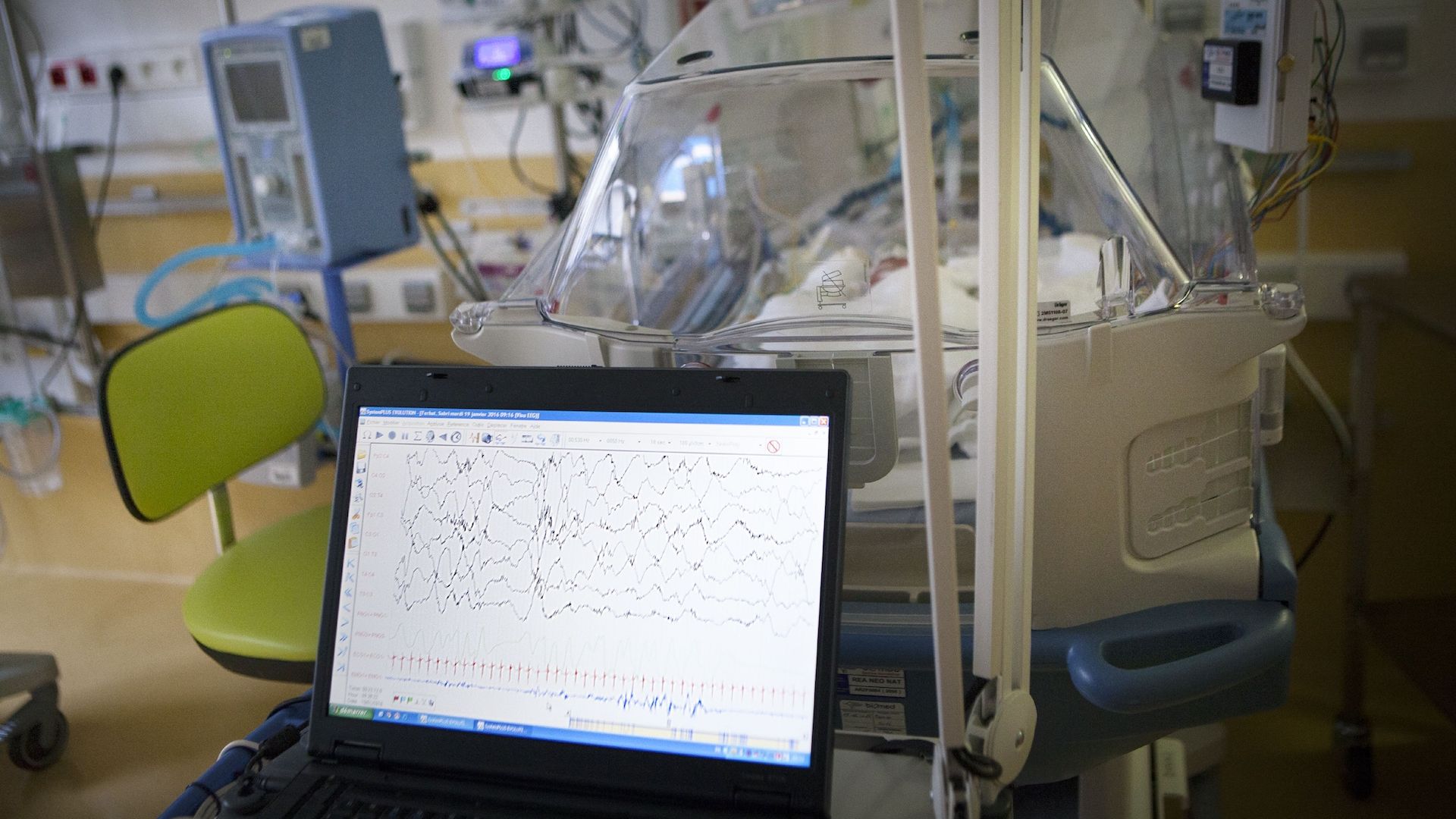 A new AI tool improved doctors' decisions in treating patients with sepsis. 