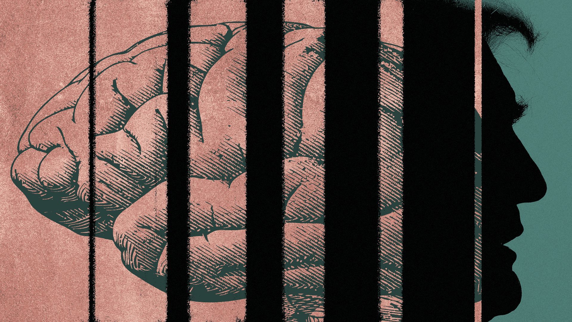 Photo illustration of a drawing of a brain with growing gaps in it that reveal a silhouette of Donald Trump.