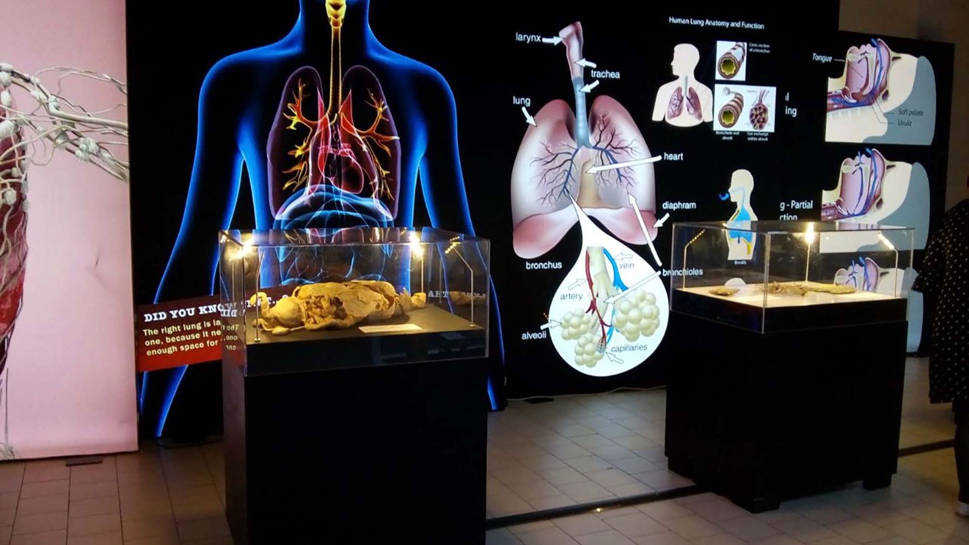 Photo: Courtesy of the Bodies: The Science Within