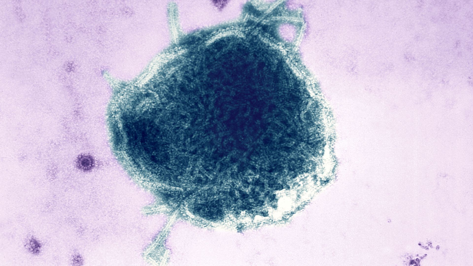 Color-enhanced electron micrograph of a virus particle: a dark blue, rounded head with light-green tail fibers, set against a purple background with scattered circular spots.